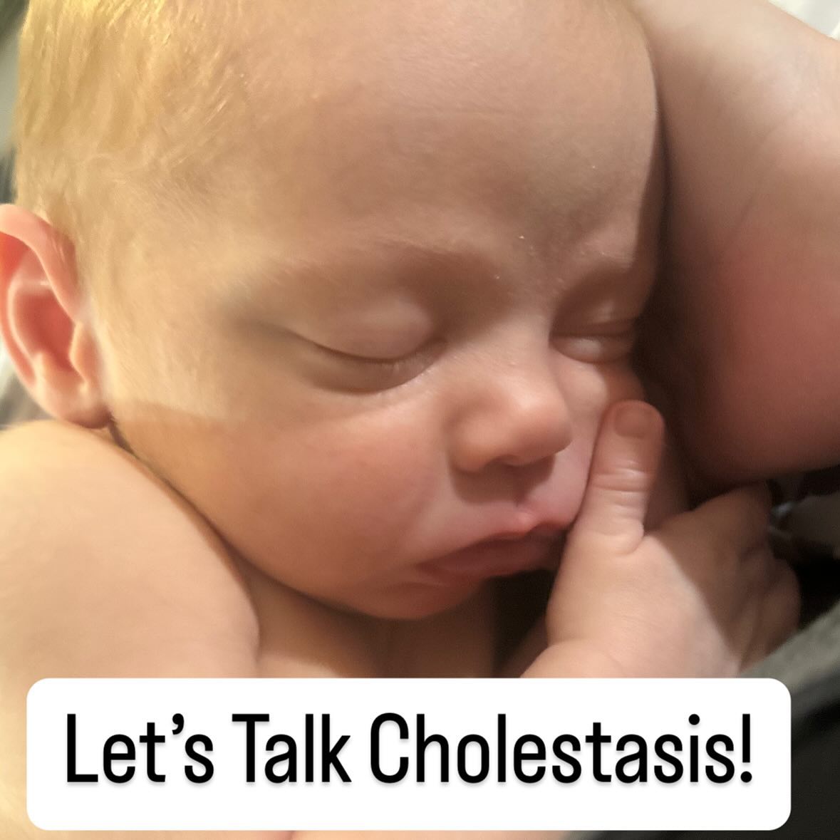 As promised, let’s talk about cholestasis of pregnancy! This ailment only affects about 1% of pregnancies so is very rare but is more serious than the other skin rashes that sometimes come with pregnancy. The classic symptom that is often what leads to a diagnosis is itching of the hands and feet WITHOUT a rash! This is the symptom that led me to get my lab work done that confirmed that I indeed had ICP (Intrahepatic Cholestasis of Pregnancy). There are other symptoms as well, and yes I had them all, but these are often missed and see as normal pregnancy aches or seen as upcoming pre/eclampsia. The lab tests done to diagnose ICP are bile acids and checking liver functions. ICP does not always affect the liver making the levels abnormal, however in severe cases like my own, it will show an elevation and show liver impairment. The reason we care about cholestasis is that the acids and toxins that build up can cause stillbirth. This is why we offer an early induction because this is one of those scenarios where baby truly is better out than in. Typically we can wait until 37 weeks but sometimes in severe cases 36 weeks is preferred. I know these facts are scary but please remember this is VERY RARE and the nice thing is just because you have it with one pregnancy in no way means you will have it with the next.
Take away message: Tell your doctor or midwife if you have itchy hands and feet with no rash! As a midwife I’d rather test 10 mamas who tell me their hands were itchy one night and rule it out as being normal swelling causing the rash than miss one severe case because she didn’t know to tell me about her hands and feet being itchy 🫶🏻
#midwife #cnm #pregnancy #pregnant #cholestasis #icp #inductionoflabor #hospitalbirth #highriskpregnancy