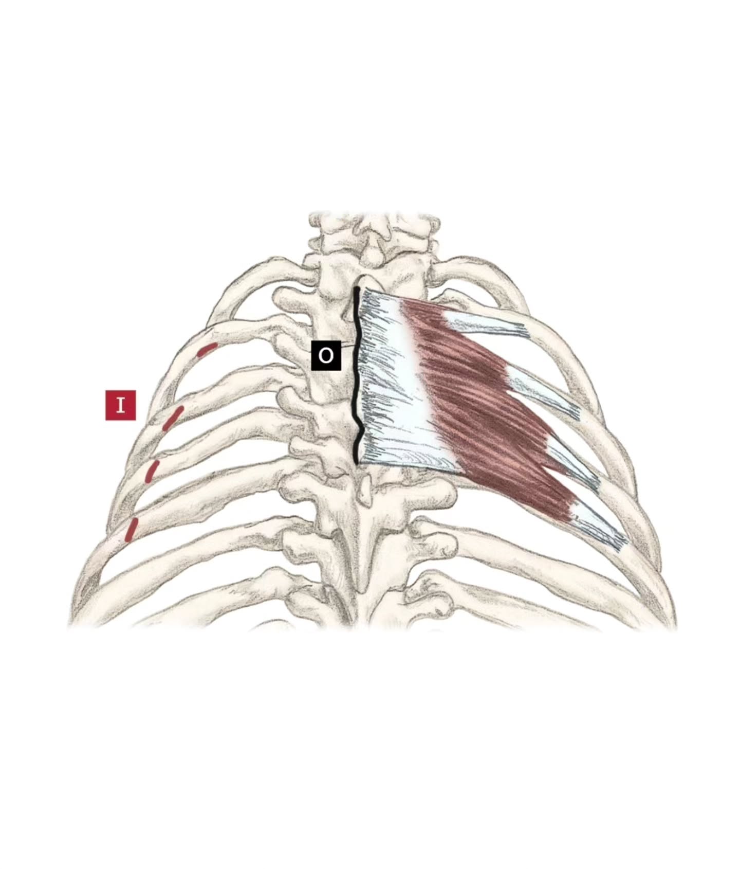 Muscle(s) Monday Serratus Posterior Superior & Serratus Posterior Inferior.
The serratus posterior superior is a thin, often overlooked muscle located in the upper back beneath the rhomboids and trapezius. It originates from the spinous processes of the lower cervical and upper thoracic vertebrae and travels outward to attach along the upper ribs (typically ribs 2–5).
From a massage therapy perspective, this muscle often becomes involved when the upper back feels tight, restricted, or fatigued, especially in people who spend long periods sitting, typing, or holding tension through the shoulders. Because it sits underneath larger muscles, it can quietly contribute to that familiar feeling of stiffness between the shoulder blades.
Functionally, the serratus posterior superior assists in elevating the ribs during inhalation. When we take a deep breath in, this muscle helps lift the ribs upward and outward, allowing the lungs to expand more fully.
This is one reason why full, intentional breathing can make such a difference in how the upper back feels. When the ribs move freely, the muscles that support them can do their job with much less strain.
Further down the back sits its partner muscle: the serratus posterior inferior.
Like the superior portion, it also runs from the spine outward to the ribs, but it lives lower in the body. It originates from the lower thoracic and upper lumbar vertebrae and attaches to the lower ribs (typically ribs 9–12).
While the serratus posterior superior helps lift the ribs during inhalation, the serratus posterior inferior helps depress the ribs during exhalation. Together, these muscles help coordinate the rhythm of breathing — one assisting the ribs to rise, the other helping them settle back down.
From a therapeutic perspective, this lower muscle can sometimes contribute to tightness through the thoracolumbar region, the area where the rib cage meets the low back. When breathing becomes shallow or restricted, these muscles may not move through their full range of motion.
To support these muscles well, the key is surprisingly simple: big, full breathing.
📷: The Trail Guide to the Body