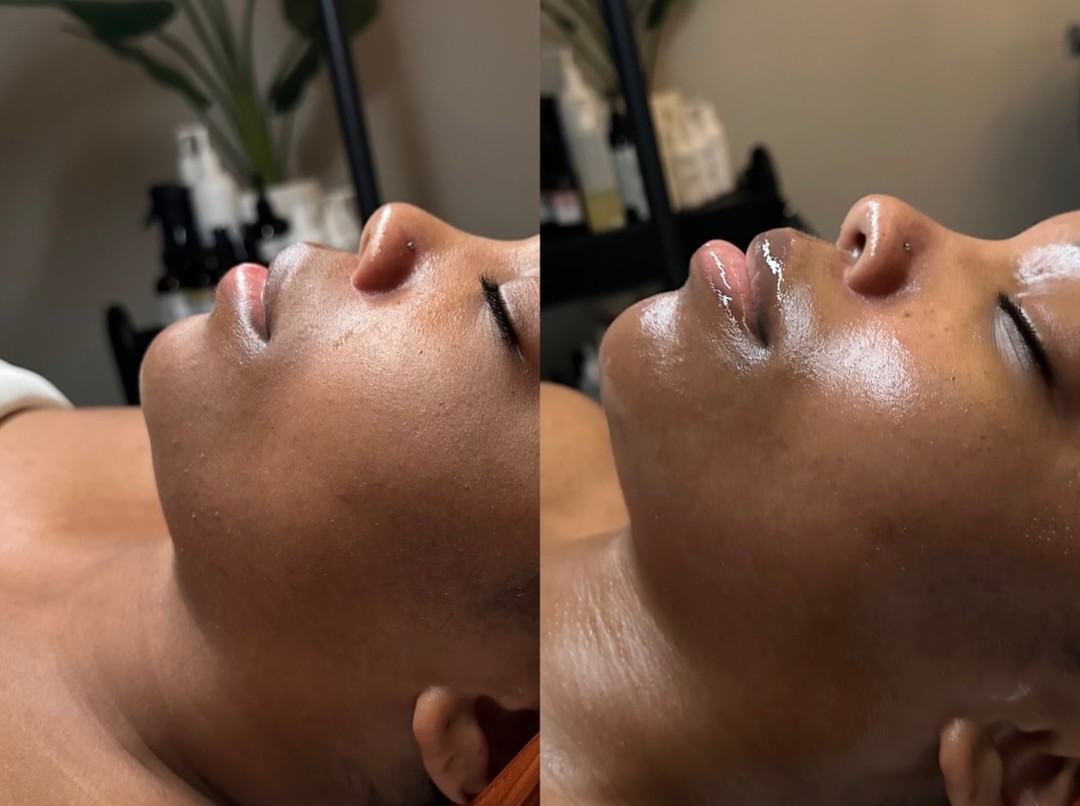 the contour is unmatched with our sculpting facial🤌🏻