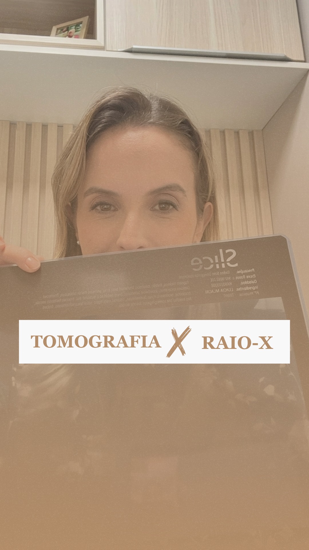 Quando indico tomografia, não é por protocolo automático.
É porque determinadas cirurgias exigem uma visão tridimensional da região.
O raio-X é excelente para muitas situações. Mas ele mostra apenas duas dimensões.
Em cirurgia delicadas, implantes ou sisos inclusos, profundidade importa.
A tomografia permite:
• Planejamento tridimensional
• Avaliação real da espessura óssea
• Visualização precisa de nervos e estruturas delicadas
• Redução de riscos
• Mais previsibilidade
Ela não é um excesso. É um recurso que aumenta segurança e precisão.
Cada caso é analisado individualmente. E o exame indicado acompanha essa necessidade clínica.
👉 Se você precisa de avaliação para implantes ou cirurgia, agende sua consulta pelo link da bio.
📍 Atendimento em Belo Horizonte
#implantodontia #cirurgiabucomaxilofacial #tomografiaodontologica #dentistabh #planejamentocirurgico