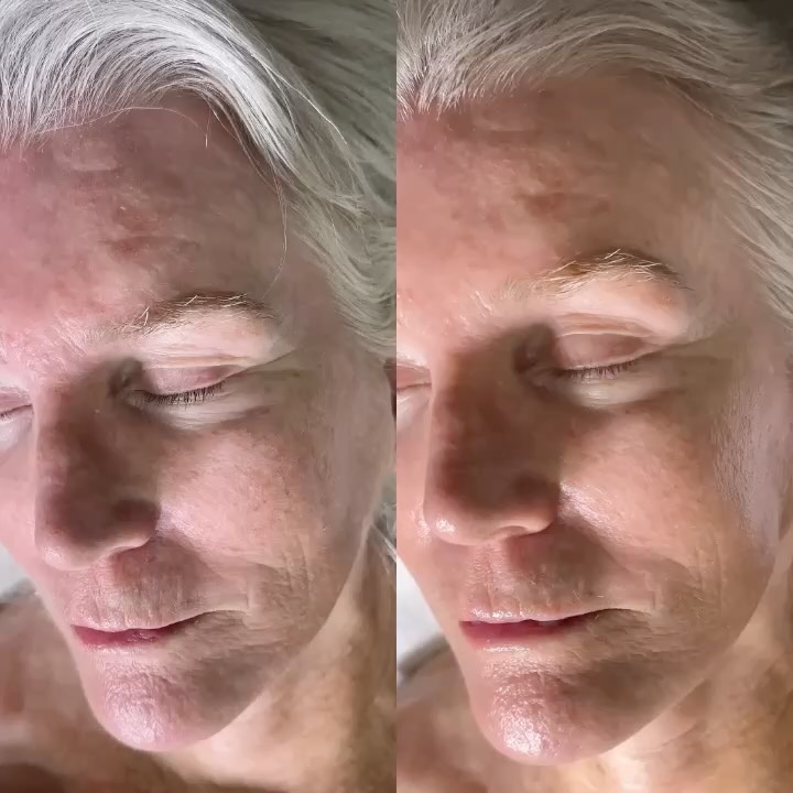 My clients facial focused on hydration, gentle resurfacing, and antioxidant protection for smoother, brighter, healthier skin ✨
#HydratingFacial #AntiAgingFacial #FacialTreatment #CypressEsthetician #SkincareRoutine