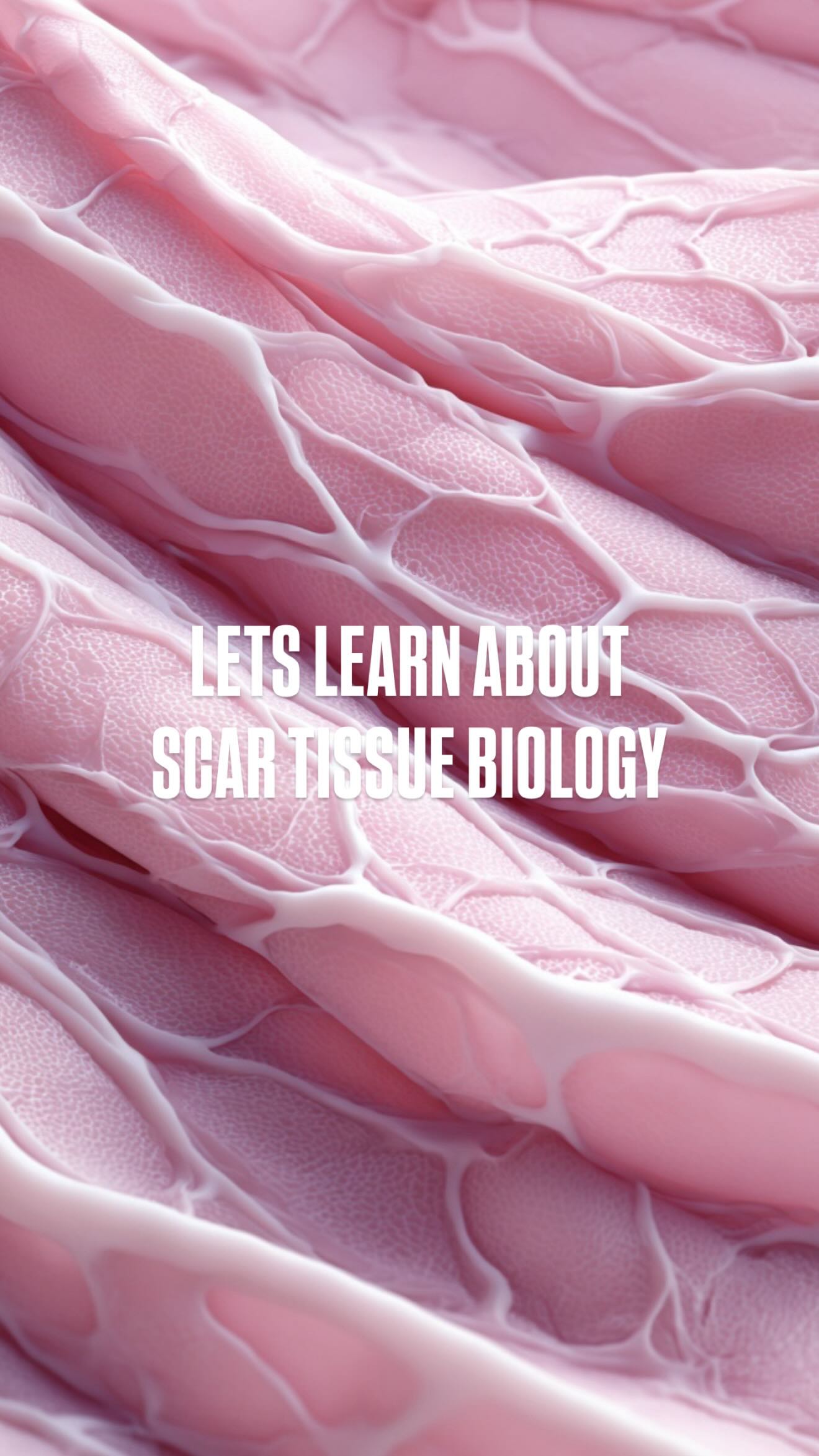 𝐒𝐂𝐀𝐑 𝐓𝐈𝐒𝐒𝐔𝐄 𝐁𝐈𝐎𝐋𝐎𝐆𝐘 & 𝐖𝐇𝐘 𝐒𝐂𝐀𝐑𝐒 𝐓𝐀𝐍
Scars don’t behave like normal skin… and that’s where most people get confused 👇🏼
When your body heals an incision or trauma, it lays down collagen in a fast, disorganized way to close the wound. This creates scar tissue that is:
• Thicker
• Less elastic
• Poorly vascularized
• Structurally different from healthy skin
Now here’s the part no one explains properly…
𝐒𝐜𝐚𝐫𝐬 𝐚𝐧𝐝 𝐬𝐮𝐧 𝐞𝐱𝐩𝐨𝐬𝐮𝐫𝐞 ☀️
Scar tissue has altered melanocyte activity (the cells responsible for pigment). This means:
• Some scars overproduce pigment → hyperpigmentation (darkening)
• Others lack pigment → hypopigmentation (lighter than skin)
• UV exposure can make scars tan faster, darker, and more unevenly
And unlike normal skin… this pigmentation can become long-term or permanent if not managed early.
𝐖𝐡𝐚𝐭 𝐭𝐡𝐢𝐬 𝐦𝐞𝐚𝐧𝐬 𝐟𝐨𝐫 𝐩𝐨𝐬𝐭-𝐨𝐩 𝐜𝐥𝐢𝐞𝐧𝐭𝐬:
Healing isn’t just about closing the incision — it’s about how the tissue remodels over time.
This is why we focus on:
• Controlled inflammation
• Proper compression protocols
• Advanced therapies (𝐀𝐬𝐩𝐞𝐧, lymphatic, red light)
• Protecting scars from UV exposure
Because a “healed” scar is not the same as a well-healed scar.
Your results don’t end in the operating room… they’re preserved in the healing phase.
—
📍Trust Surgery Consultants
📲 Book your post-op protocol
#ScarHealing #PostOpCare #Fibrosis #ScarTissue #LymphaticDrainage AspenTherapy PostOpRecovery Hyperpigmentation MedicalAesthetics TrustTheProcess