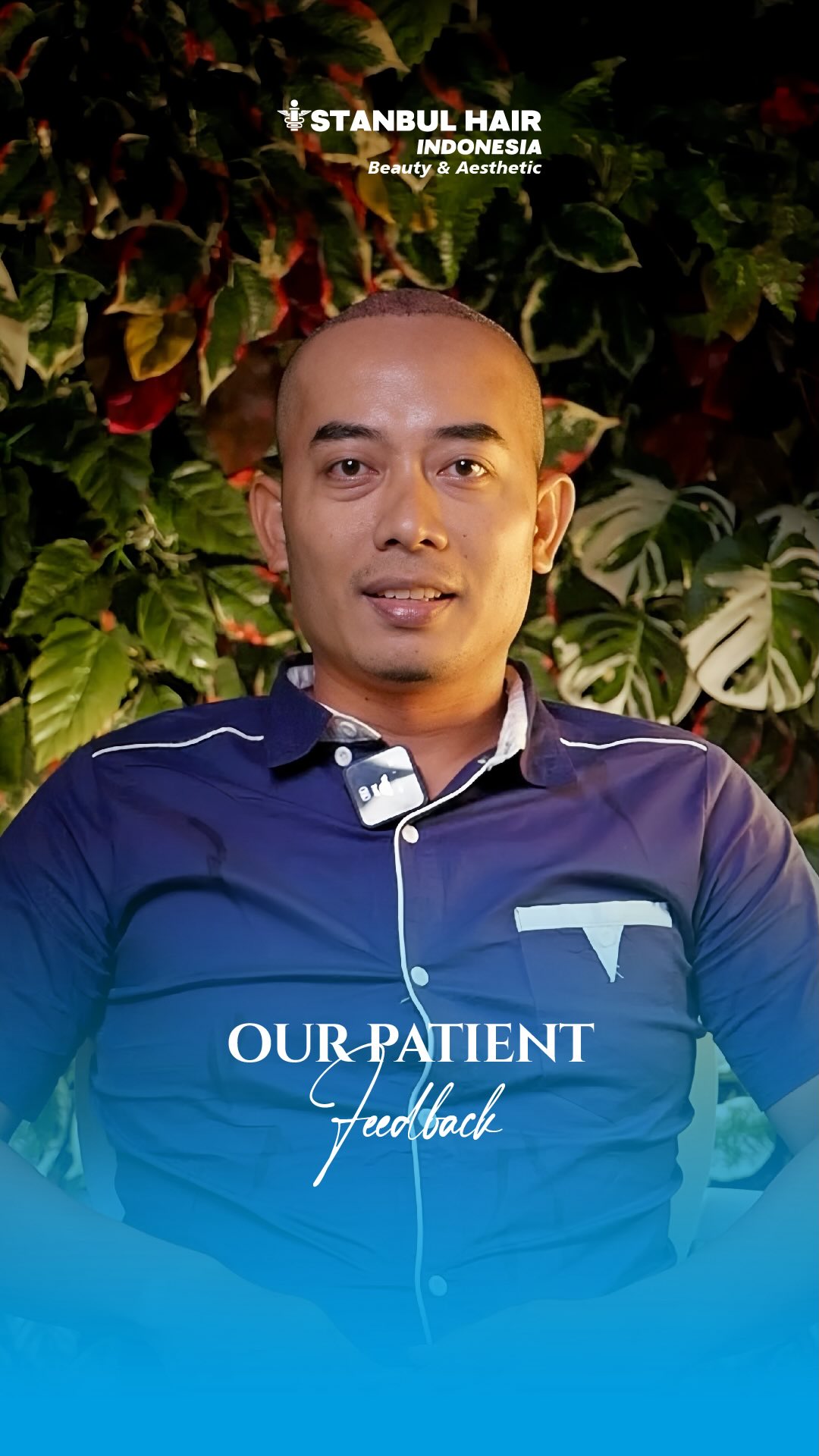 4300 grafts—langkah nyata menuju perubahan yang lebih percaya diri.
Dari Bogor 🇮🇩 ke Jakarta, keputusan sederhana yang membawa hasil lebih natural, lebih rapi, dan terlihat lebih muda.
Di Istanbul Hair Indonesia, setiap proses dikerjakan dengan detail dan ketelitian tinggi—karena hasil yang baik selalu dimulai dari penanganan yang tepat ✨
—
4300 grafts—a real step toward a more confident you.
From Bogor 🇮🇩 to Jakarta, a simple decision that leads to more natural, cleaner, and more youthful results.
At Istanbul Hair Indonesia, every step is handled with great attention to detail—because great results always start with the right treatment ✨
⸻
#HairTransplantIndonesia #FUEIndonesia #HairRestoration #NaturalResult #ConfidentLook