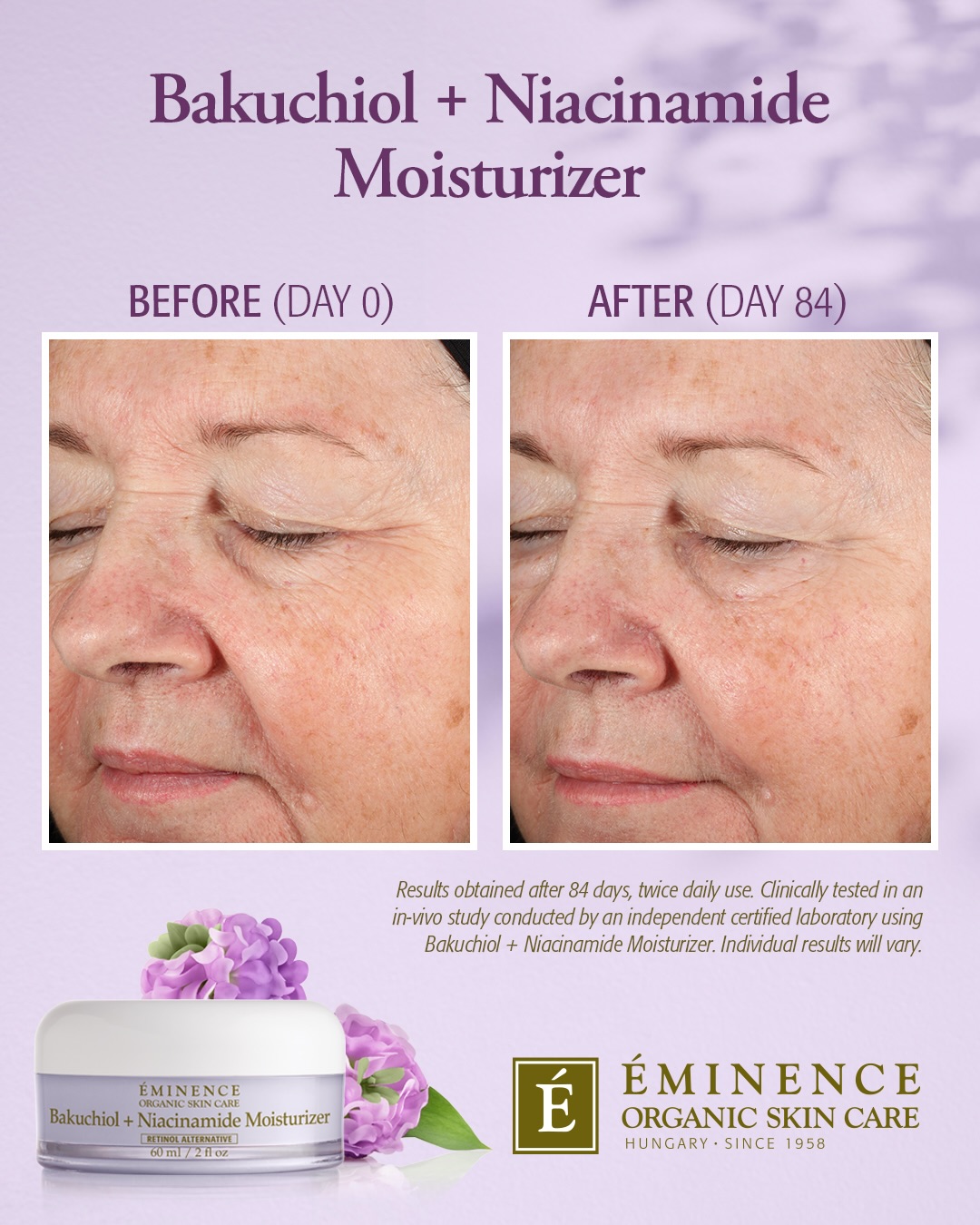 STOP SCROLLING if you want smoother skin🛑👇🏻
Two powerhouse ingredients- one incredible result= youthful, smooth and restored hydration!!💜
This award winning moisturizer combines a gentle natural form of retinol (Bakuchiol), with the calming powerhouse ingredient that does it ALL (Niacinamide). This pairing smooths wrinkles while visibly firming skin, minimizing large pores and uneven texture, with NO visible irritation👏🏻👏🏻
If you’ve been wanting to try retinol but are nervous of the potential irritating side effects- start here! This lightweight but deeply hydrating daily moisturizer is safe for all skin types- especially combination skin!🫶🏻
🏆Winner of Best Active Moisturizer, Social & Personal Best Beauty Buys, 2025
🏆Winner of Best Retinol Alternative, Cosmopolitan Holy Grail Beauty Awards, 2024
🏆Winner of Best Moisturizer, Skin Inc. Readers’ Choice Awards, 2024
🏆Winner of Best Men’s Anti-Aging Moisturizer, Spa & Wellness MexiCaribe Product Awards, 2023
#bakuchiol #niacinamide #retinolcream #eminence