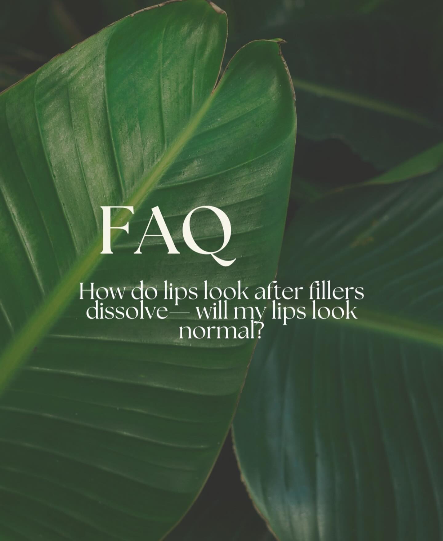 Want to know what happens to your lips after fillers? Swipe for all the details and don’t forget to share with friends who might be interested! 🔎Book now at www.winkswhims.com