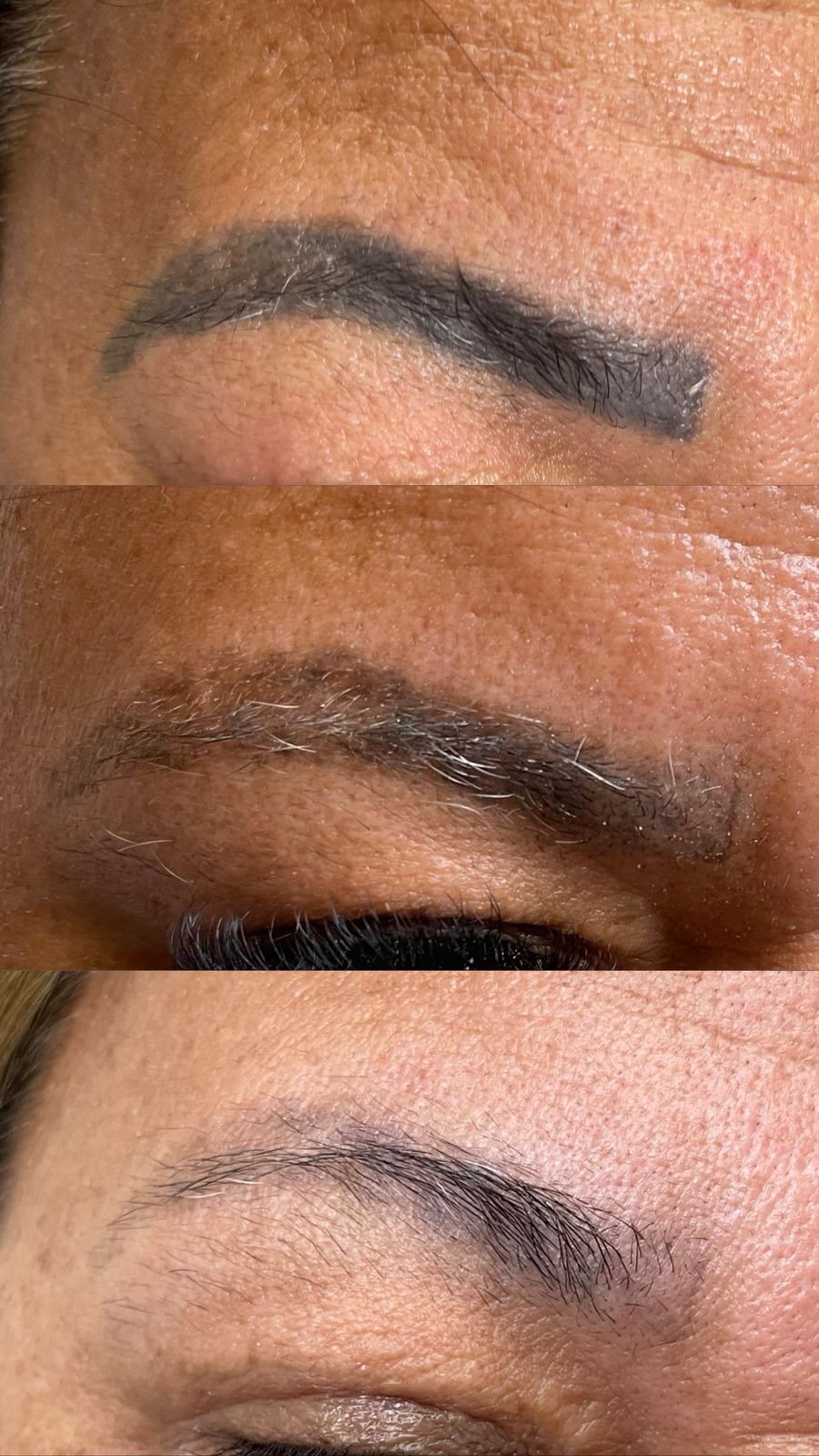 A despigmentação a laser é o primeiro passo para quem deseja renovar as sobrancelhas e conquistar um resultado realmente natural com a técnica mais atual: a nanopigmentação. ✨
Quando existe um pigmento antigo , escurecido, saturado, avermelhado ou com formato ultrapassado , ele interfere totalmente no novo procedimento. O laser remove esse pigmento aos poucos, clareando a região e deixando a pele pronta para receber fios mais delicados, finos e realistas.
A nanopigmentação é uma técnica moderna, leve e super natural, mas para alcançar todo esse efeito bonito é essencial trabalhar em uma base limpa, sem resíduos de pigmento antigo. Assim, os fios podem ser posicionados corretamente, o design fica harmônico e o resultado final muito mais elegante e atual.
✨ Despigmentar é investir no resultado perfeito.
Na Flow, cuidamos de cada etapa para que você tenha sobrancelhas renovadas, modernas e com acabamento impecável.🌹
Flow Estética Facial e Corporal
Telefone: (61) 99890-4816
Endereço: QI 9/11, Bloco M, Edificio Center Sul, sala 22 - Lago Sul
Site: https://www.flowestetica.com/
#lavieen #lagosul #lavieenday #botox #dysport #toxinabotulinica #preenchimentolabial #spafacial #acidohialuronico #limpezadepele #flowestetica #blackpeel #bioestimulador #bioestimuladordecolageno #tratamentoestrias #lipoenzimatica #clareamento #smartgr #pdrn #skinbooster #altafrequencia #radiofrequencia #fiosdepdo #lifting #liftingcorporal #ultraformer #microemacrofocado #dermotonus #vapordeozonio #dermapen