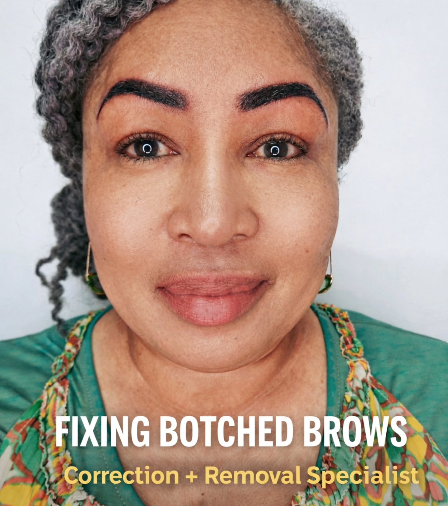 Not all brows are created equalโฆ and unfortunately, not all artists are either.
If youโre dealing with brows (or any PMU) that feel too dark, uneven, misshaped, or just "not you anymore" โฆI can help you.๐ฉท
I specialize in safely lightening and correcting botched or outdated PMU...so we can either bring your natural brows back to life or create something that actually fits your face ๐ซถ
You donโt have to live with results you hate.
โจ Real results
โจ Safe removal process
โจ Customized correction plan
โจ Brows, liner, lips, & small tattoo removal
If this feels like you, donโt overthink itโฆ
DM โBROW FIXโ or text to book your consultation ๐
๐ South Florida
๐ฟ www.iconicbeautyandink.com
๐ 954-780-6230
#browcorrection #pmuremoval #salinetattooremoval #southfloridabeauty #browtransformation