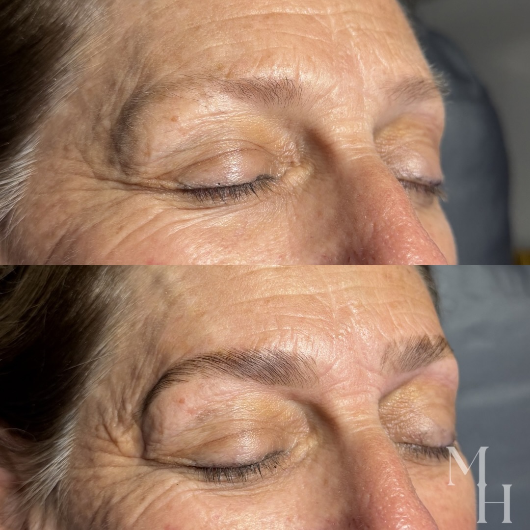 Soft structure. Fuller presence. Effortless mornings.
This sweet client came in with very sparse, light, and thin brows she was filling in every single day. With a gentle brow lamination, we were able to redirect the growth, build shape, and create the illusion of fullness without adding heaviness.
The result is a lifted, polished brow that still feels natural and appropriate, just enhanced in all the right ways.
No more daily penciling. Just wake up and go 🤍
📍 Location:
664 Scranton Road, Suite 101
Brunswick, GA 31520
Inside Skinology Clinical Skincare
💬 Let’s Chat About Your Esthetic Goals!
📲 Call/Text: 912-223-9954
💌 DM or Facebook Messenger
🗓️ Schedule a Consultation Anytime
💻 Book Online 24/7 (link in bio)