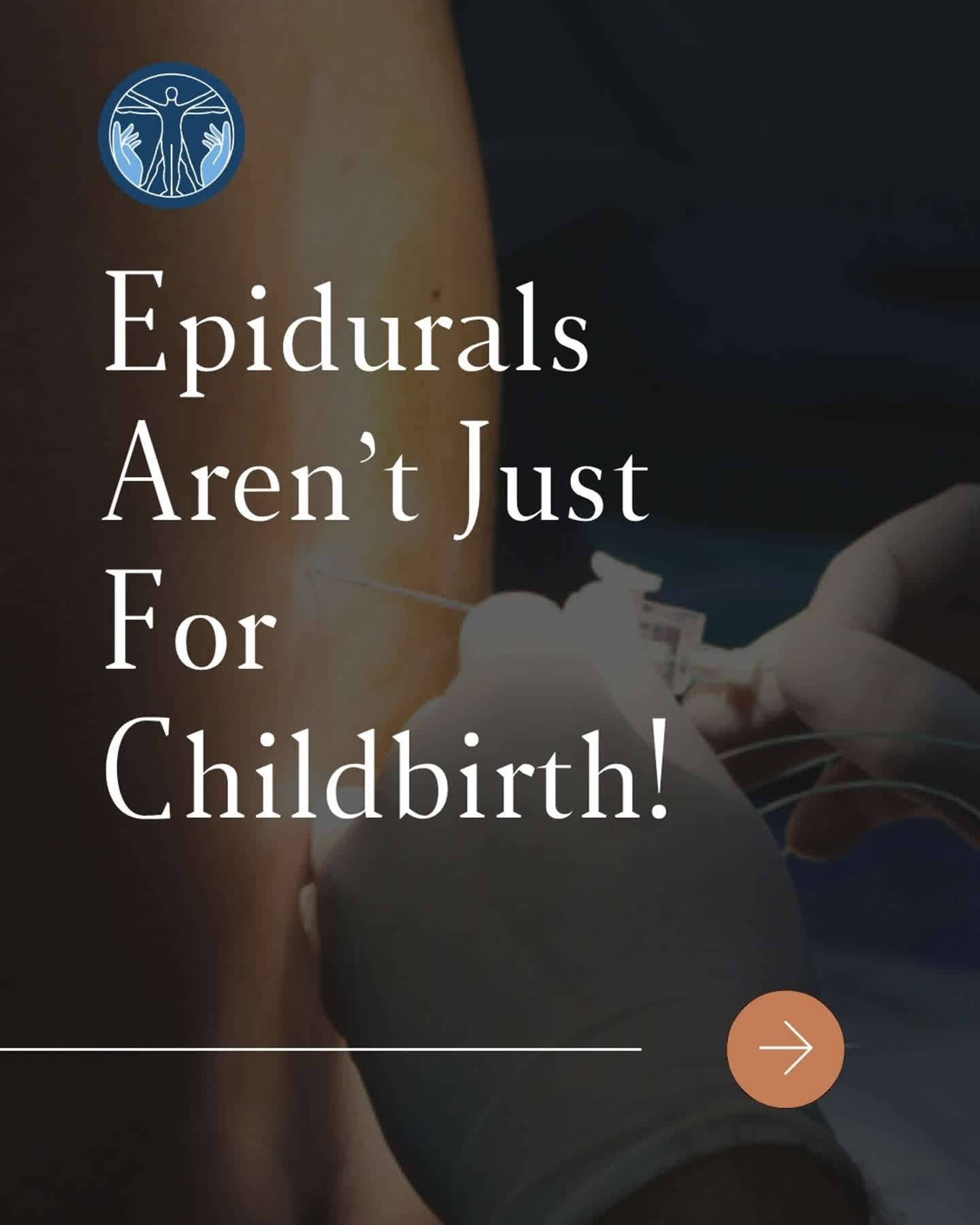 Epidural steroid injections are one of the most effective tools in pain management: for back pain, neck pain, sciatica, and more.
Swipe to learn how it works →
✅ Minimally invasive
✅ Done under fluoroscopy for precision
✅ Reduces nerve inflammation
✅ Most patients feel significant relief within days
Curious if you're a candidate? Call us. 📞 870-972-0411 | 📍 Jonesboro, AR
#EpiduralBlock #BackPain #PainManagement #InterventionalPain #ThePainCenter #Sciatica #JonesboroAR