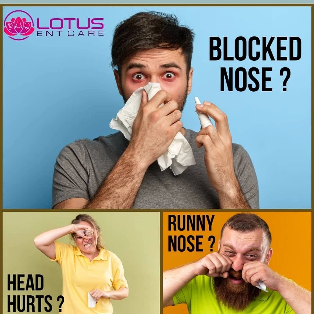 Nose block can be super annoying. Your nose drips. You sound funny when you talk. And just when you want to blow your nose to finally breathe again, nothing comes out.
Many people think a stuffy nose is the result of too much mucus in the nasal passages. However, a clogged nose is actually caused by inflamed blood vessels in the sinuses. These irritated vessels are usually triggered by a cold , flu, nasal allergy, or a sinus infection.
Visit us for a complete ENT check up
9008735781 or www.lotusentcare.con for appointments.