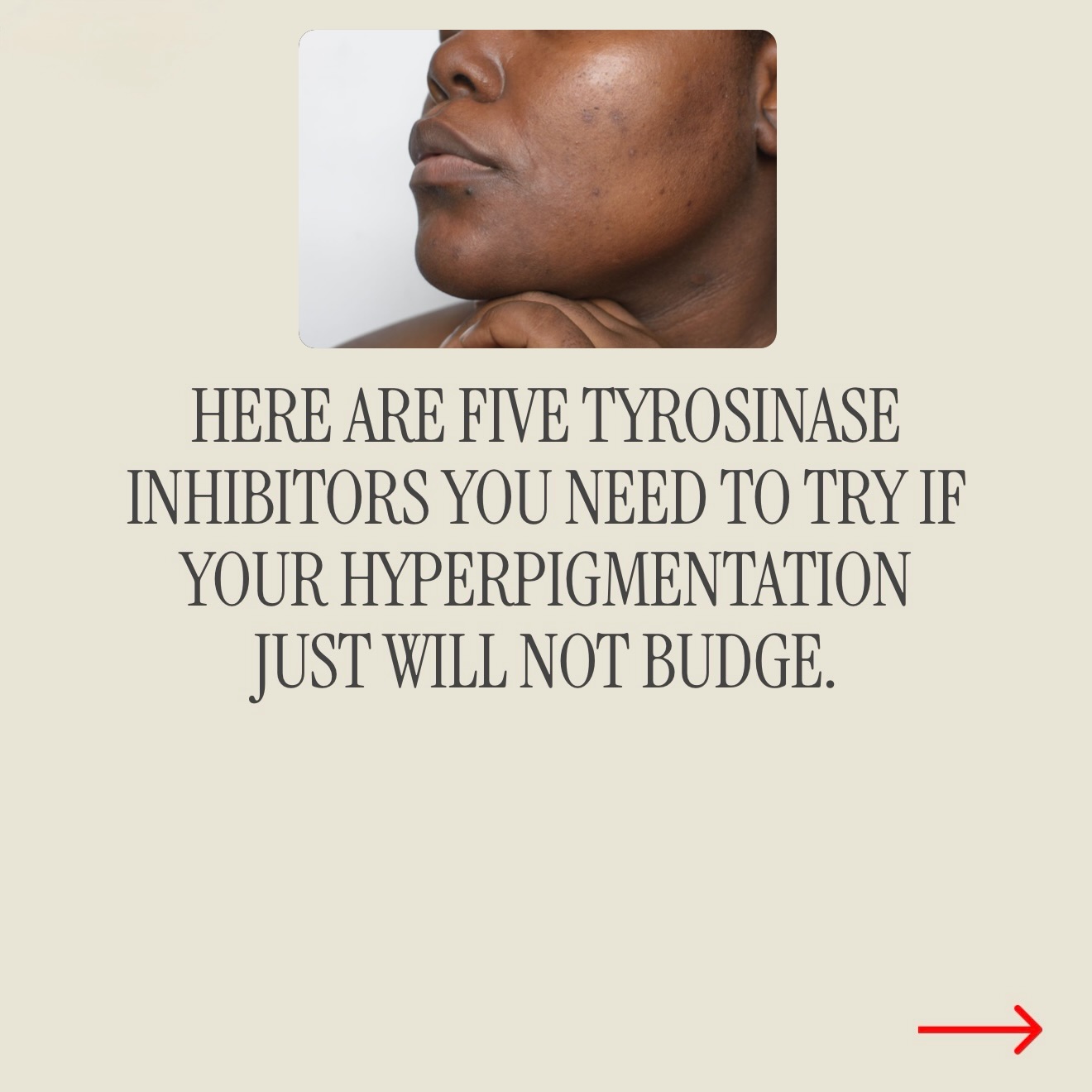 You are one step closer to getting even skin if you pick the right hyperpigmentation treatment for your concern .
Not all brightening actives work the same way so understanding how they target pigment will help pick the right treatment.
#hyperpigmentationtreatment #darkspot #tranexamicacid #kojicacid