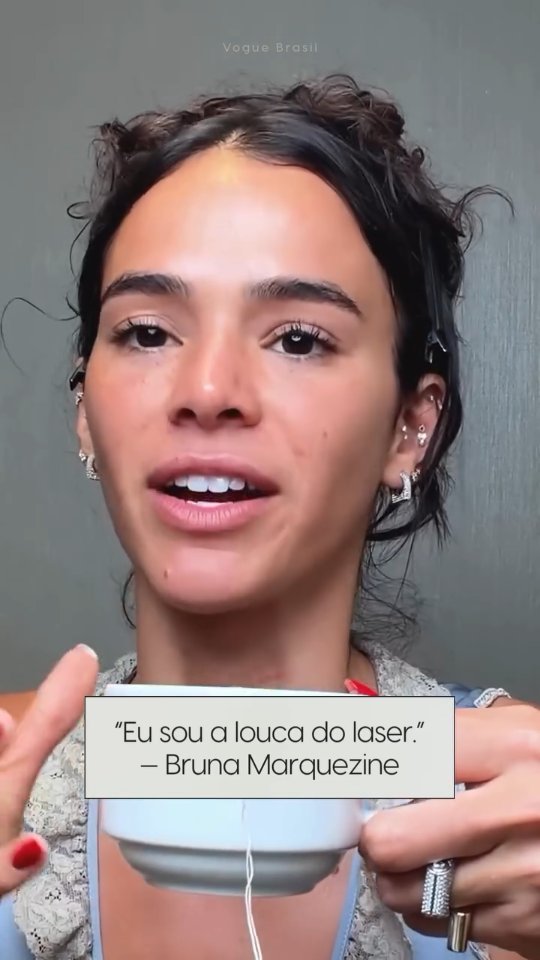 A grande diferença de quem cuida da pele hoje em dia é saber usar a tecnologia a seu favor. ✨
Muita gente ainda tem medo de procedimentos, mas a verdade é que os lasers modernos são os maiores aliados do banco de colágeno e da textura da pele!
E vou te contar o por que você deve apostar na tecnologia em consultório:
- Precisão: Age exatamente onde o creme não chega.
- Estímulo Real: Acorda o seu colágeno "adormecido".
- Prevenção: Trata manchas, poros e firmeza de dentro para fora.
Cuidar da pele com o que há de mais moderno não é sobre mudar quem você é,
mas sobre potencializar a sua melhor versão com a ajuda da ciência. 🧬
Não é gasto, é INVESTIMENTO na sua autoestima a longo prazo!
O "glow" de milhões vem da tecnologia e protocolos certos 😍
E você, já experimentou o poder de um laser ou ainda está só no hidratante básico?
Conta aqui nos comentários! 👇
#brunamarquezine #belezanatural #laser