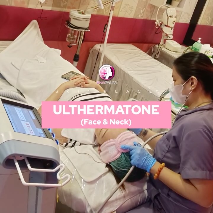 Experience the magic of Skin Place Ulthermatone for Face & Neck 💖 — the non-invasive treatment that helps firm sagging skin, define your jawline, and smooth fine lines without surgery. Using advanced ultrasound technology, Ulthermatone stimulates deep collagen production for a naturally lifted, youthful look over time. Perfect for anyone wanting that snatched yet natural glow!
Skin Place is Your Skin's Place.
✨ See comment section for more details! ✨
#SkinPlace #Ulthermatone #FaceAndNeckLift #SkinPlaceGlow #NonSurgicalLift #YouthfulRadiance