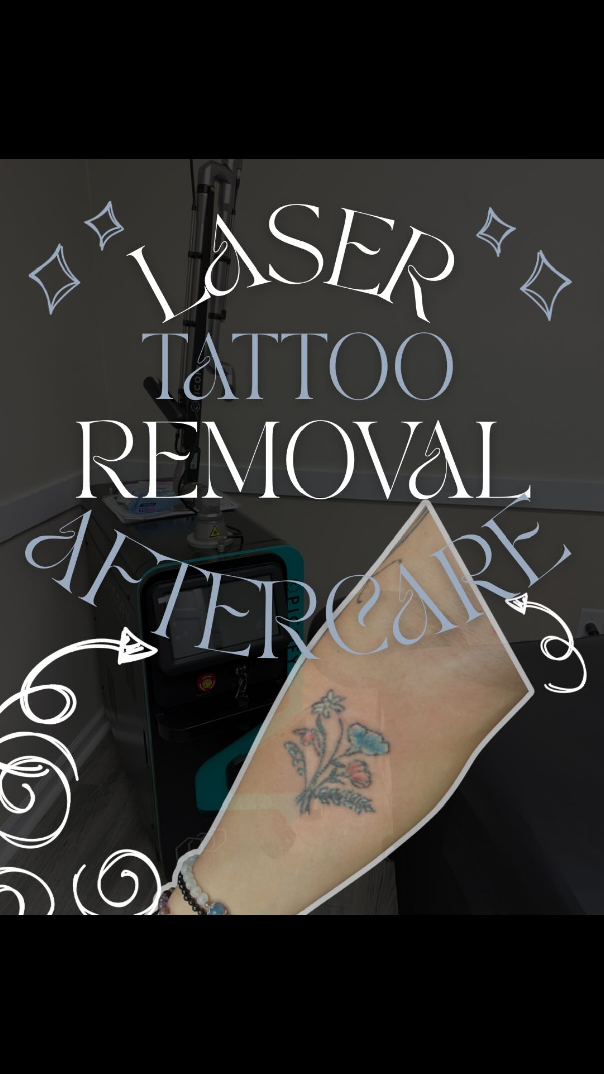 A few days behind but here is how to care for your tattoo after laser removal. For tattoo removal you can anticipate this process for 3-10 days depending on how long it takes to initially heal. The goal is to protect the skin as it is healing.
For PMU aftercare is different, you won’t need to keep your brows covered
Questions about tattoo removal, we offer free consultations. Link in bio
#lasertattooremoval #tattooremoval #indytattoo #tattooremovalprocess