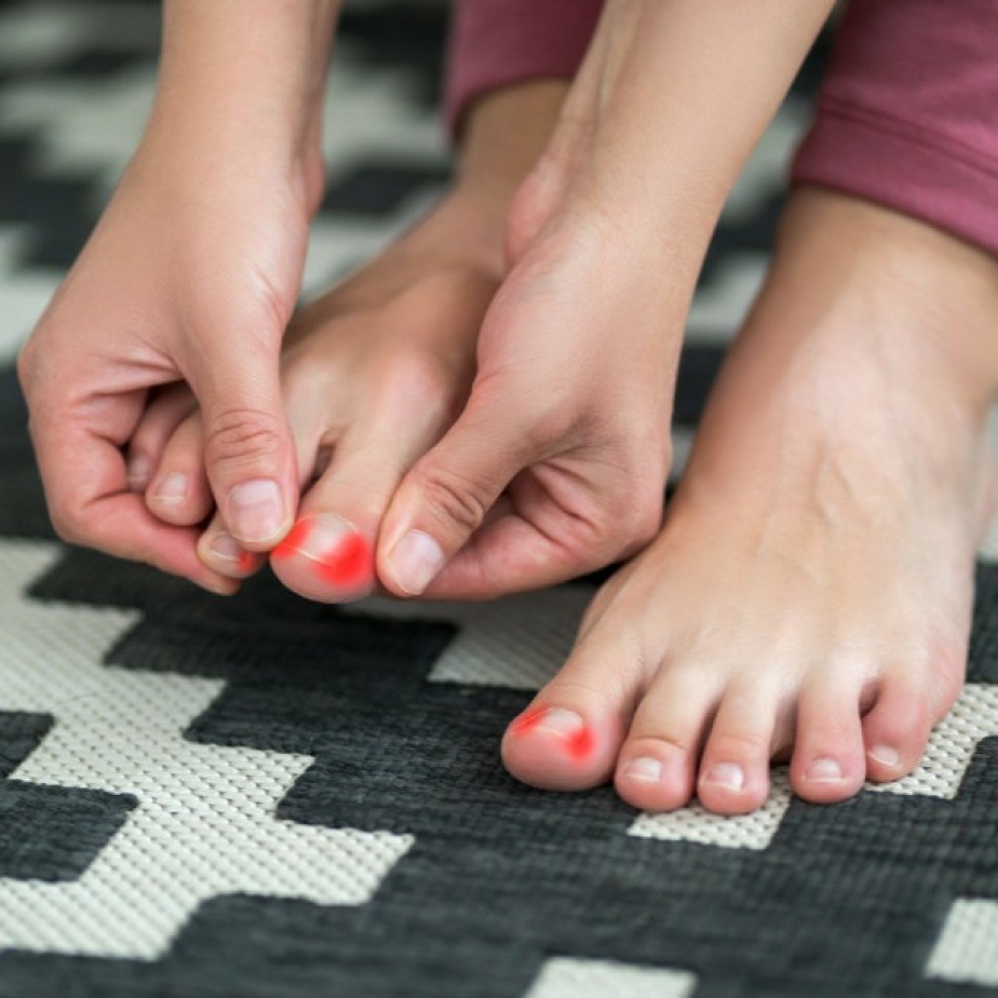 👣 Dealing with a painful toenail? Ingrown toenails are a common issue we see in clinic—and they can be incredibly uncomfortable if left untreated. If you’re noticing pain, redness, swelling, or tenderness around your toenail, it could be a sign of an ingrown nail.
The good news? Treatment is simple and effective when addressed early. Don’t let it stop you from staying active or enjoying your day.
Book an appointment and get back on your feet comfortably:
www.surfcoastpodiatry.com