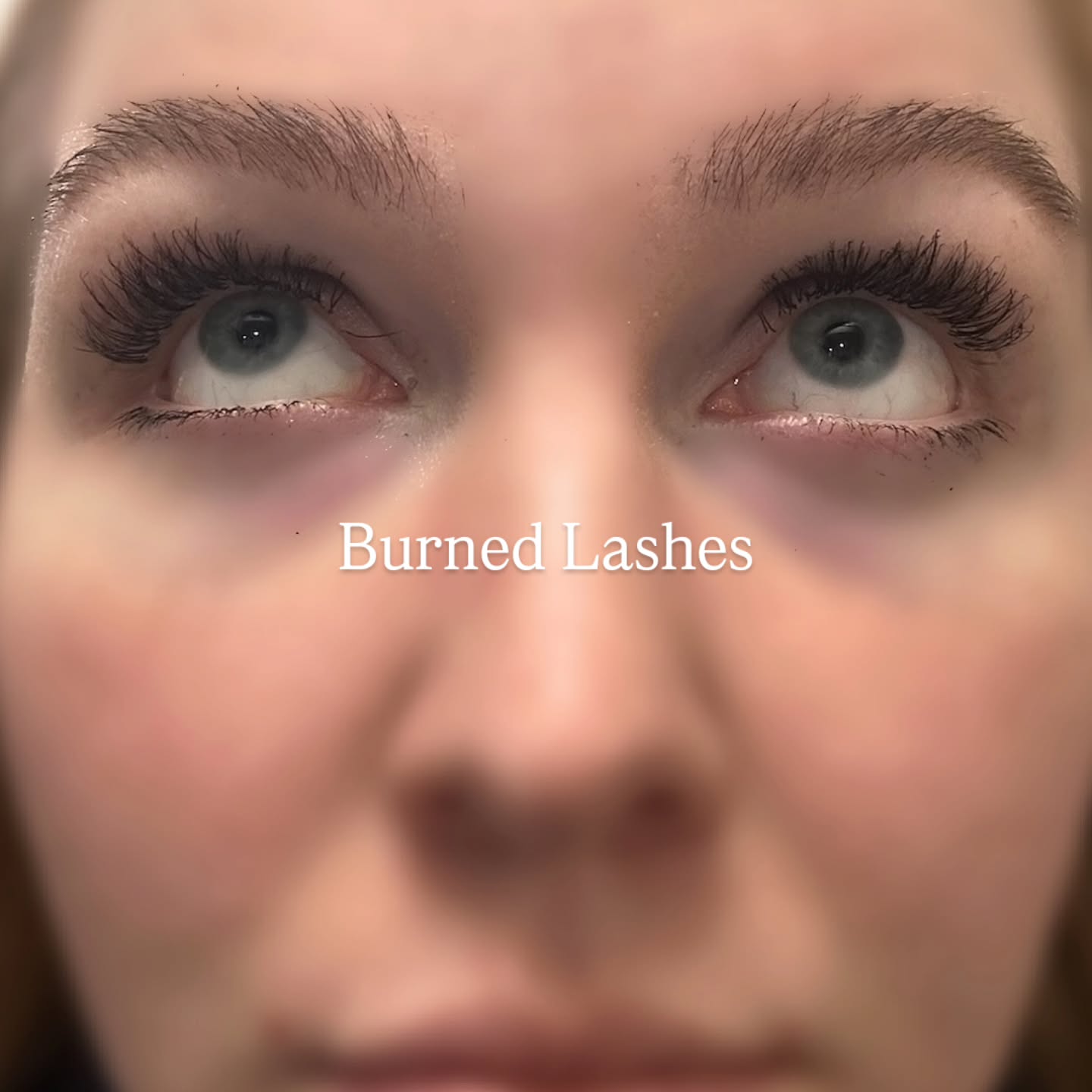 UH OH! Got too close to the flame. 🔥
Working in a kitchen, it's bound to happen.
Listen, mistakes happen.
Thankfully, this was minor. This could've been SO much worse and I'm so grateful this was only her extensions that got damaged.
Opal-free did her job and kept those lashes ON. 😂👌
Instead of doing a whole new set on a whim, we did an emergency partial removal and replacement of the extensions that got the most damage. Next fill appointment, we will get rid of the remaining! The goal was to mask the damage as much as we could for now. ✅ This saved us time, and helped with her cost.
This is the perfect opportunity to remind you that lashes are FLAMMABLE 🥵. They will melt and crinkle at the first sign of too much heat. Keep a safe distance to any extreme temperatures 🌡️
Stay safe out there, ladies!