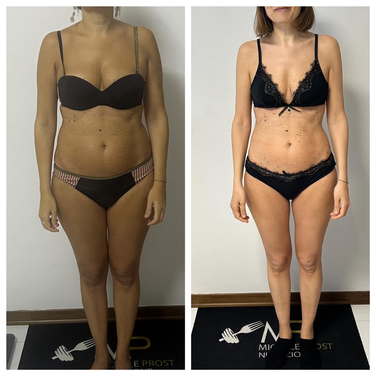 ⚠️⚠️⚠️ percorso concluso!
Oggi vi mostro questo bel cambiamento di una ragazza che non aveva mai fatto un percorso nutrizionale.
Come spesso succede ci si avvicina ad un nutrizionista quando il fai da te non funziona più e oltre a non riuscire a perdere qualche chiletto ci si ritrova da “grandi” a rendersi conto che non si parla più di “basta mangiare meno” ma che invece bisogna saper mangiare e conoscere alcune regole importanti.
Cambiare le proprie abitudini per fare spazio a delle nuove, non è semplice.
Ci vuole tempo e pazienza.
Poi ci si rende conto che stiamo meglio fisicamente e che siamo anche riusciti a togliere quei chiletti che ci davano fastidio.
Questa ragazza è stata molto brava ad approcciarsi ad un nuovo modo di mangiare, ad essere più organizzata nei pasti e anche pronta a nuove combinazioni di alimenti.
Brava 👏
#alimentazione #nutrizionista #change #cagliari