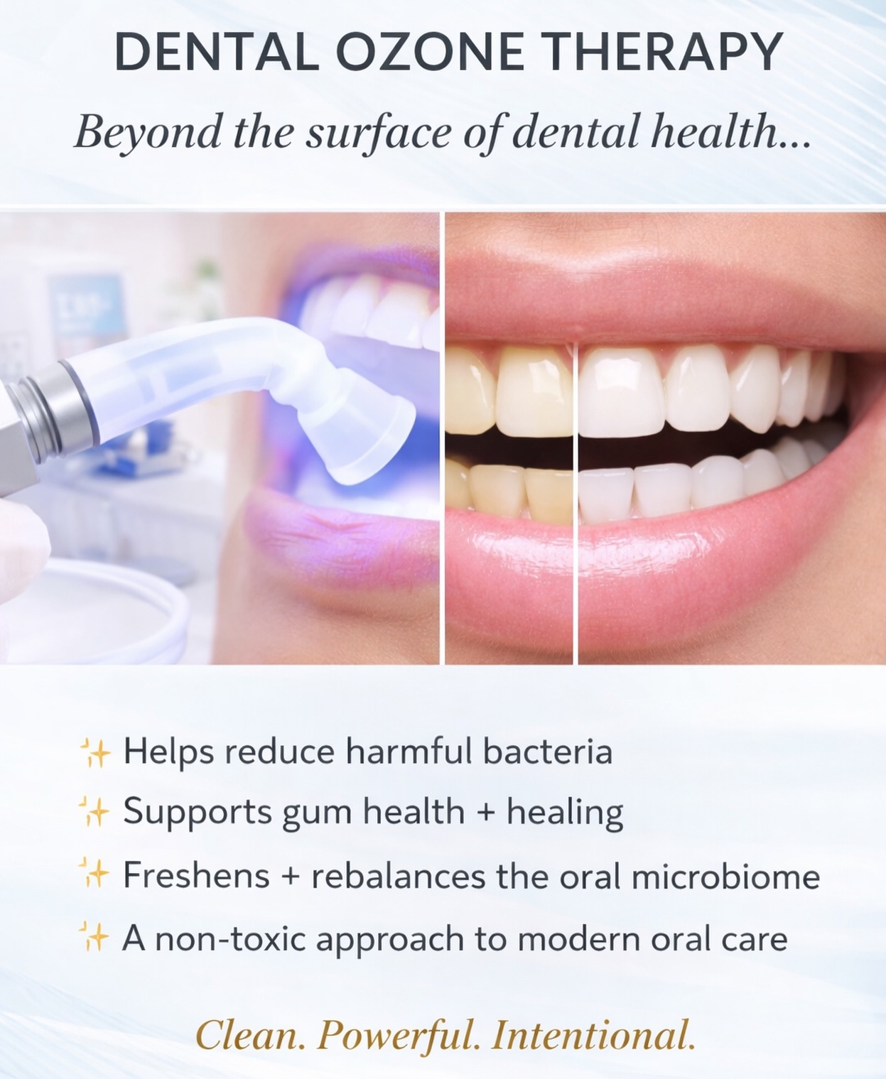 Struggling with cavities, gum issues, or ongoing dental problems?
It may be time for a Dental Detox.
✔ Reduces harmful bacteria + biofilm
✔ Supports gum health + reduces inflammation
✔ Strengthens teeth + supports enamel
✔ Relieves sensitivity + discomfort
✔ Supports early-stage cavity prevention
✔ Whitens teeth naturally
✔ Supports faster healing
1K+ Verified Buyers
Trusted, at-home solution
A New Approach to Oral Health
Ozone therapy works at the root — helping shift the oral environment where issues begin.
👉 Shop the Dental Ozone Kit
🔗 dentalozonekit.com
#DentalOzoneKit #OzoneTherapy #HolisticDental #AtHomeOralCare #DentalDetox
