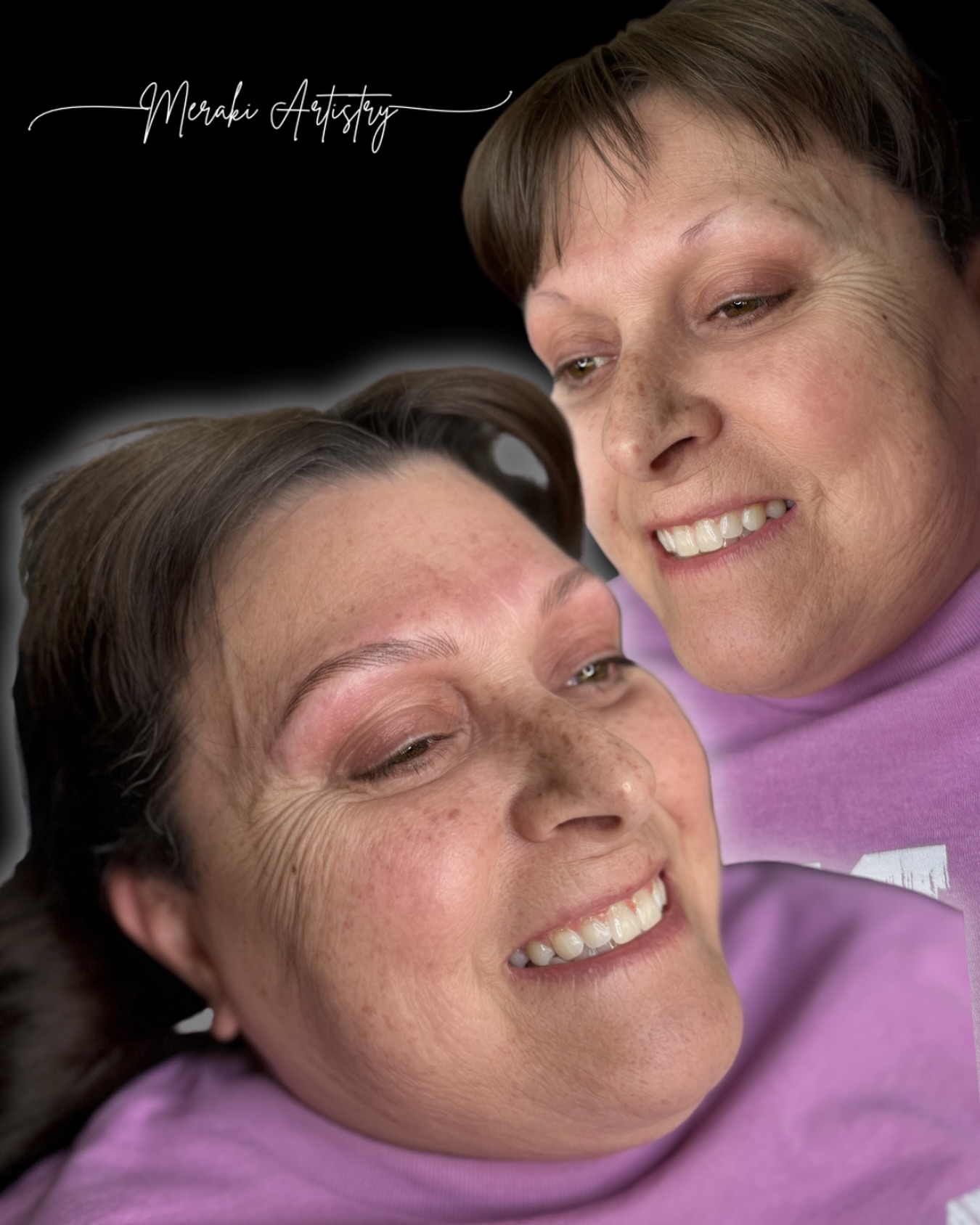 "But I don't have any brow hair" - it's a fear many clients share. I'm humbled by the trust they place in me to help. One of the joys of PMU is recreating brows that are uniquely yours. From sparse to full brows, each set is tailored to you. Interested in nano brows? Schedule a free consultation today!
Using my favorite stuff as always:
Pigment: @hanafycolourspigments @hanafy.us
Cartridge: @dragonhawkofficial @bowlerestheticspro
#nanobrow #indypmu #pmu #tattoo