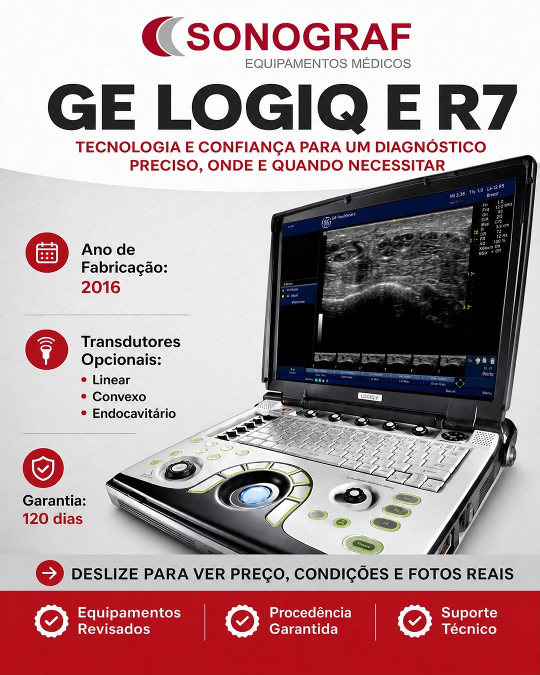 GE Logiq E R7 (2016) com 3 transdutores opcionais. Equipamento sólido, totalmente funcional, ideal para clínicas que buscam qualidade diagnóstica com investimento acessível. Chame no direct!
#ultrassom #ultrassonografia #gelogiq #logiqe #sonografequipamentos