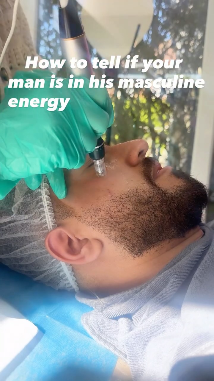 He invests in how he looks, how he feels… and how he shows up. That’s masculine. 💪
More men are stepping into aesthetics and actually taking control of their skin
Microneedling is one of the most underrated treatments for:
✔️ Acne scarring
✔️ Fine lines
✔️ Skin texture
✔️ Enlarged pores
✔️ Overall skin quality
No downtime. No overdone look. Just better skin, naturally.
This is your sign to stop neglecting your skin and start investing in it 💉🔥
If your a man and you want to get your skin looking 20 again drop us a DM to start your skin care journey now!
📍Results that speak for themselves
📩 DM to book / enquire
#MensAesthetics #MicroneedlingResults #MensSkinCare #AestheticClinic #SkinConfidence
