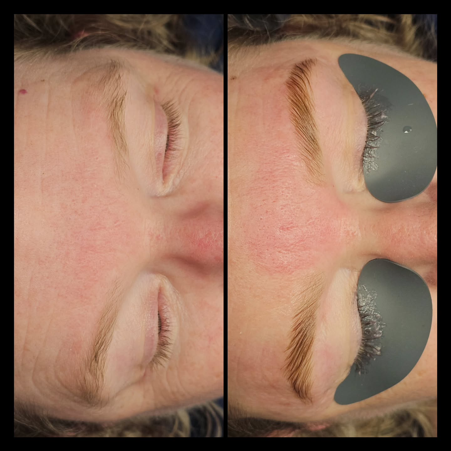 Brow Lami, Sugar & Tint on eczema prone skin with an added on Lash Tint, and Bikini Line Sugar.
Now she's vacation ready 🧳🏝️
Blondes are harder to get right when it comes to brow tint, and she unfortunately was used to people giving her light brown, which is just too dark for her. She was super happy with her results!
🌞 Let's get you summer ready!
fearlessfemmebeautyco.com ✨