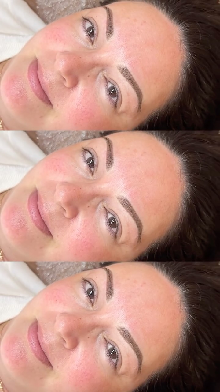 Psych 😉
Only timeless shapes, quality pigments and a highly skilled artist producing work that balances your features and stands the test of time 🤌
That is my JAM 🤝
~ Soft Ombre
~ Lasts 2+ years
~ Appears around 40% darker and bolder for the first week but heals to a beautiful soft finish that goves structure and shape whilst still looking natural.
~ Artist: Sarah Lea
~ Suitable for all skin types
~ Southport, Gold Coast 📍
~ Bookings & Info:
www.sarahleabrows.com