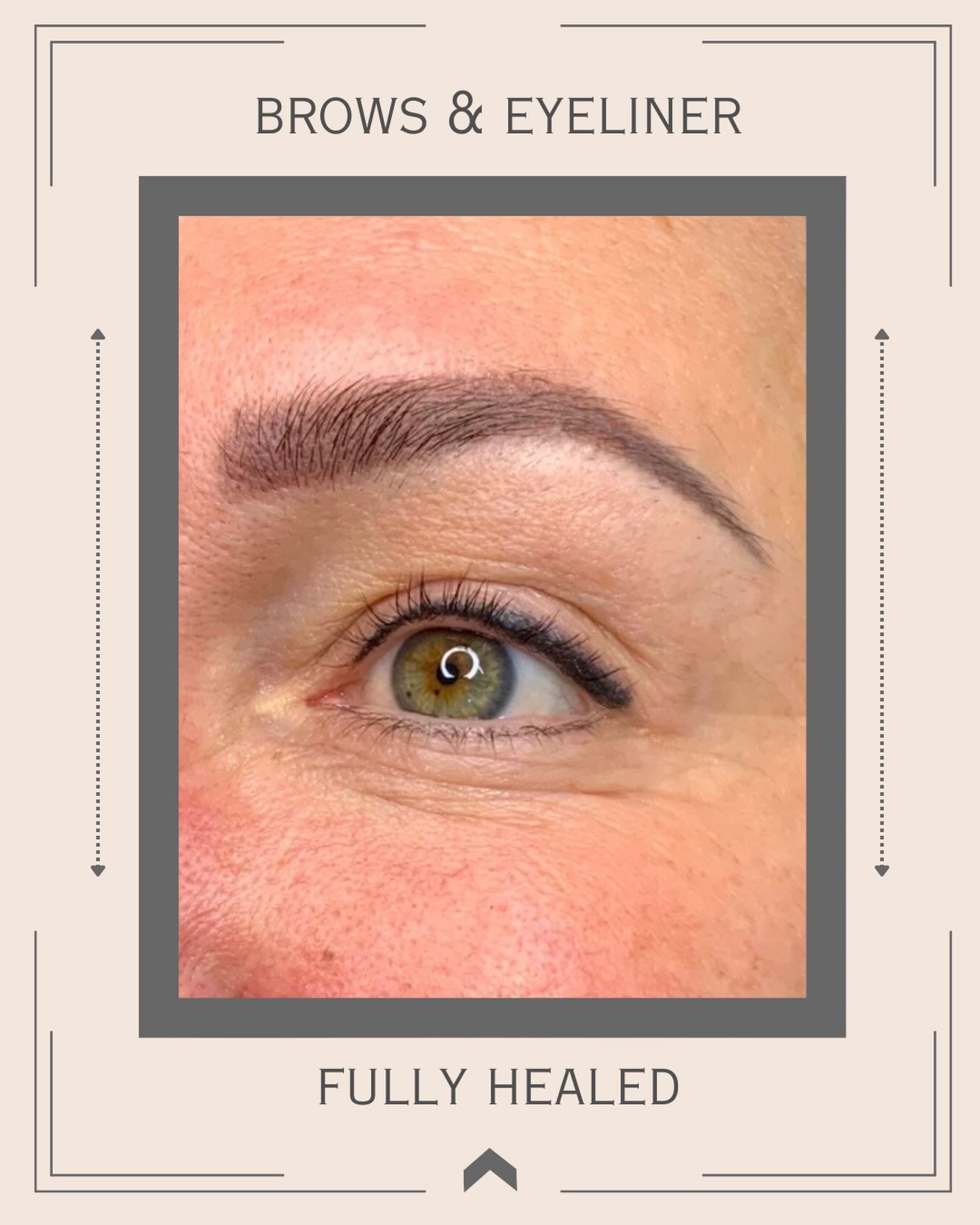 Brows & eyeliner are the perfect combo - you wake up ready to go!
Healed results matter...
It's what stays with you for a long time 🤍