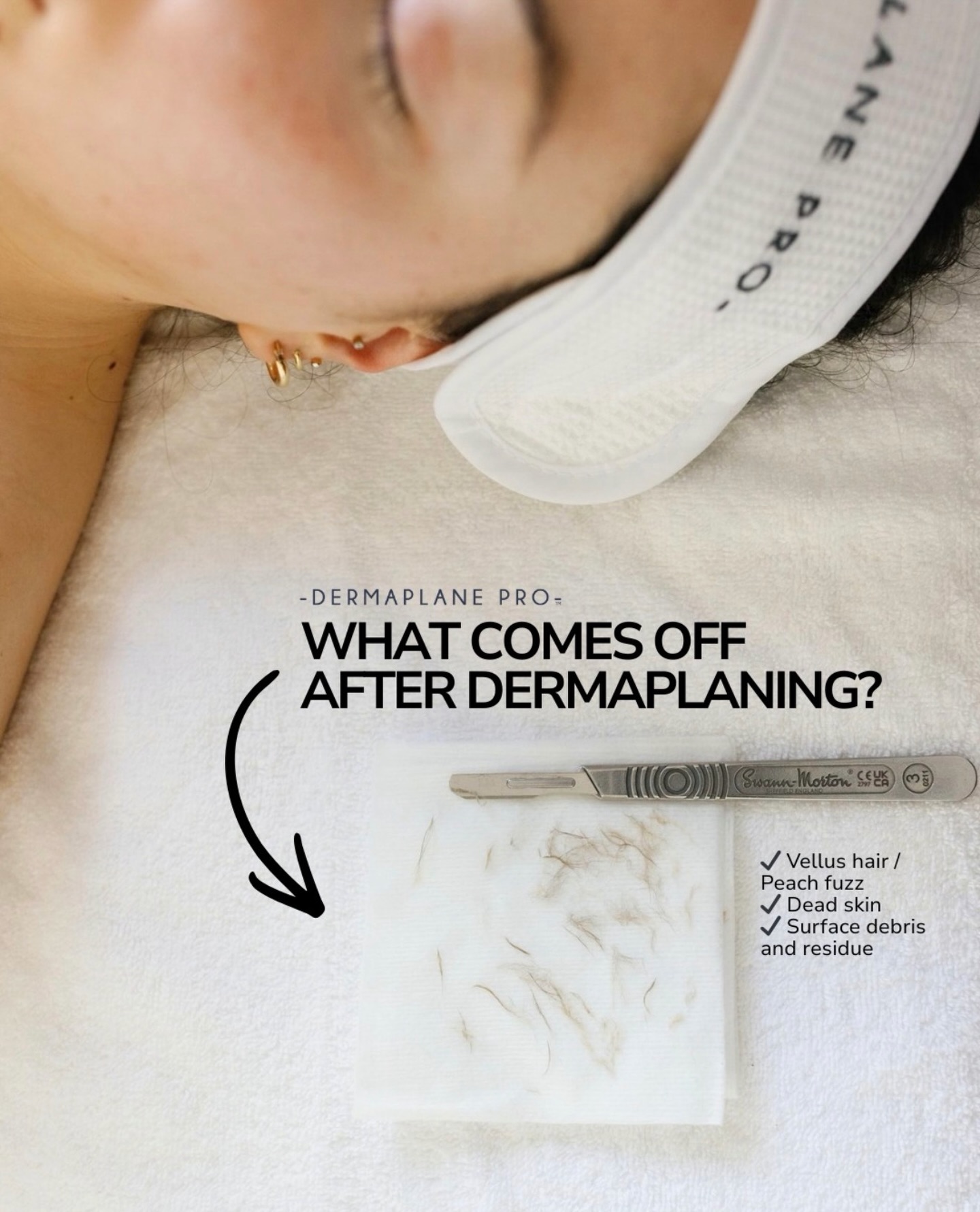 Fresh skin, instantly ✨
Dermaplaning gently removes dead skin and peach fuzz to reveal a smoother, brighter glow. Makeup goes on flawless, skincare absorbs better, and your skin feels like silk.