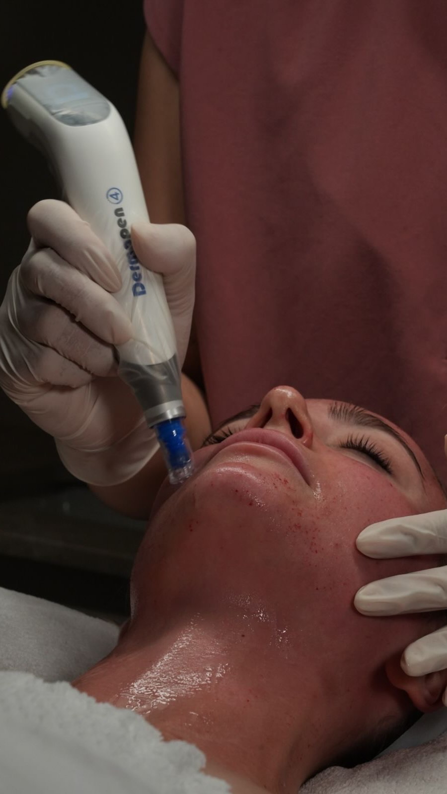 Skin that heals itself, glows louder ✨
Dermapen 4 microneedling boosts collagen, smooths texture, fades scars, and gives you that fresh, healthy glow