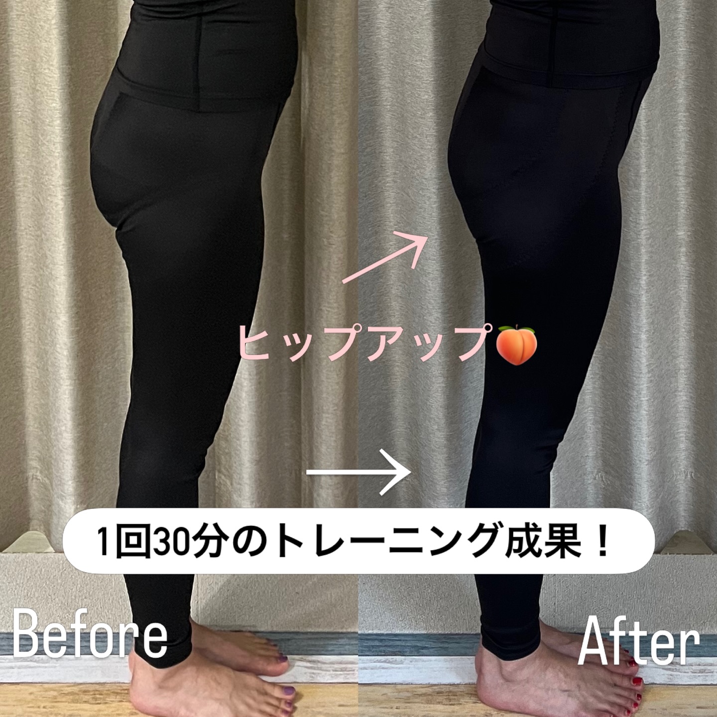 【Before After】
お客様M様✨
お尻の筋肉を上手く使うことで見事にヒップアップ大成功です👏
トレーニング初めは太ももの前側にも入りやすくピンポイントで効かせることが難しいところから始まりました!
そこでお身体の状態をみさせていただきながら骨盤の使い方、張りのほぐし、力を入れる感覚などまずは土台を作らせていただき徐々にお尻への意識をつよくしていきました🍑
トレーニングはがむしゃらにするものではなく現状のお身体と向き合い、効かせられない原因をみつけ、修正をかけていくことで意味のあるトレーニングとなっていきます☝️
n.式トレーニングでは30分という短いトレーニングでも内容を濃くすることでしっかりと成果をだしていきます!
まだまだこれからの成長が楽しみですね😊
体験¥3,000/60min
n.bodymakeでは健康で美しい身体づくりへのお手伝いをさせていただいております。
✼••┈┈┈┈┈┈┈••✼••┈┈┈┈┈┈┈••✼
ジム
@n.bodymake.2024
宮崎市阿波岐原町前浜4276-451
問合せ方法 : 公式LINEにてご連絡ください。
⋆⸜完全プライベート🕊⸝⋆
⚫︎女性専用
⚫︎ "美尻"美脚"特化型
⚫︎ヒップ専用マシーン完備
⚫︎ペアでの運動も可能
⚫︎お子様連れOK
⚫︎広々とした駐車場を完備
豊富なプランをご用意しております。
✼••┈┈┈┈┈┈┈••✼••┈┈┈┈┈┈┈••✼
#nbodymake #宮崎市パーソナルジム #宮崎市パーソナルトレーニングスタジオ #宮崎市女性パーソナルジム#宮崎市プライベートジム宮崎市キックボクシングジム