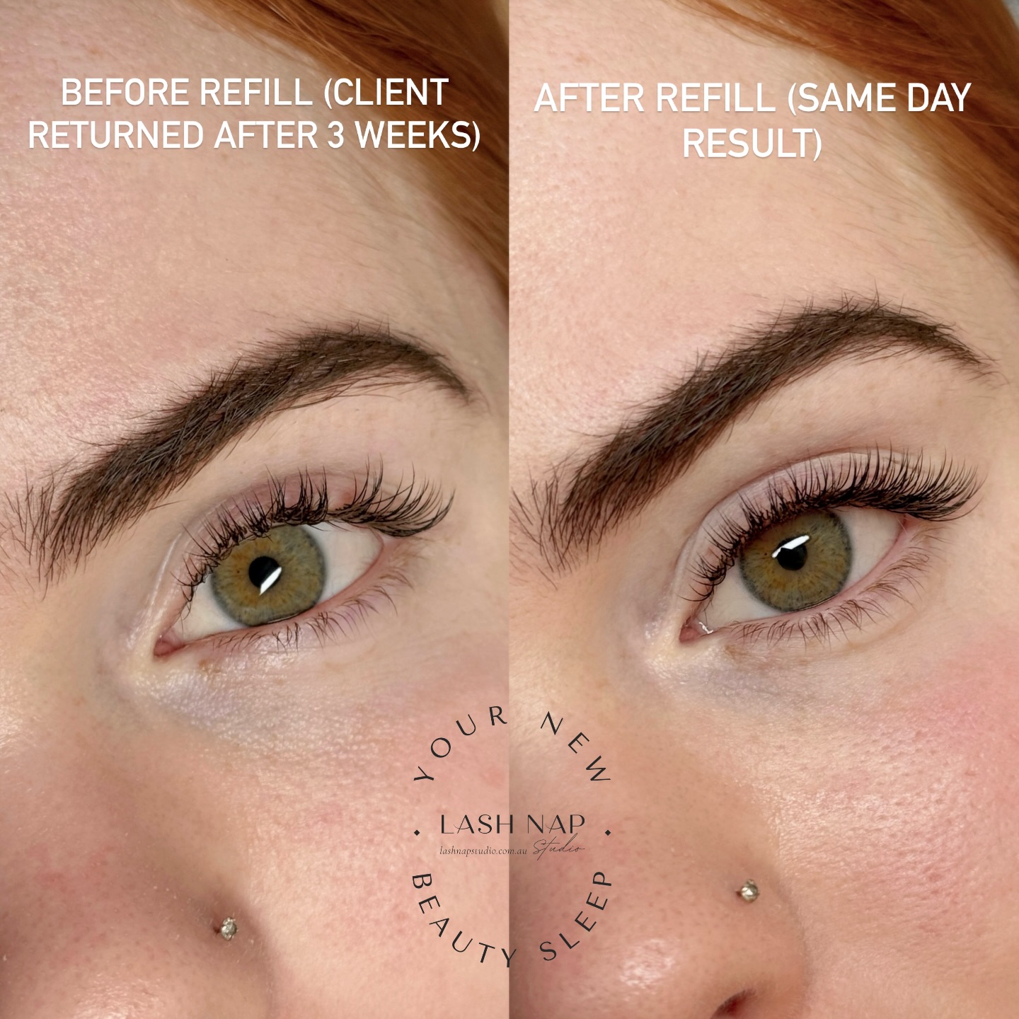 ✨Lash Retention and Refills Explained
We often get asked about lash retention, how long they last, how they look after 2 to 3 weeks, and what a refill involves.
The photos above show one of our clients who prefers a subtle classic set, with shorter lengths and slightly longer lashes at the outer corners.
The first photo shows her lashes after 3 weeks. By this stage, some extensions have naturally shed and some have grown out, so the lashes can look a bit gappy and uneven.
The second photo shows the lashes after a refill. During the appointment, the lashes are thoroughly cleaned, outgrown extensions are removed, and new lashes are applied closer to the lash line. This brings the set back to a full, fresh look.
The retention also depends on several factors, including your natural lash cycle, lifestyle, aftercare, and how oily your skin or eye area is. Things like rubbing your eyes, using oil-based products, or not following proper aftercare can also affect how long your extensions last. Because of this, retention can vary from person to person. Some clients naturally hold their lashes longer, while others may need refills sooner. To maintain a full and polished look, regular refills are recommended.
🔹Online booking:
lashnapstudio.com.au
#perthlashextensions #bedfordlashextensions #inglewoodlashes #bayswaterlashextensions #mountlawleylashes