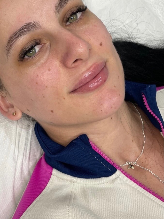 ⠀
New lip day… HALLELUJAH
__________________________
Get in touch 👇🏽
𝐃𝐌 𝐔𝐒 𝐅𝐎𝐑 𝐄𝐍𝐐𝐔𝐈𝐑𝐈𝐄𝐒
GIFT VOUCHERS AVAILABLE
SWIPE FOR CLINIC DATES
⭐️ 5 STAR GOOGLE REVIEWS
💻 www.archedaesthetics.co.uk
📱 𝗪𝐇𝐀𝐓𝐒𝐀𝐏𝐏 07517416782
📧 hello@archedaesthetics.co.uk
#lipfillerplymouth #dermalfillerplymouth #aestheticscallington #dermalfillercallington #aestheticsliskeard