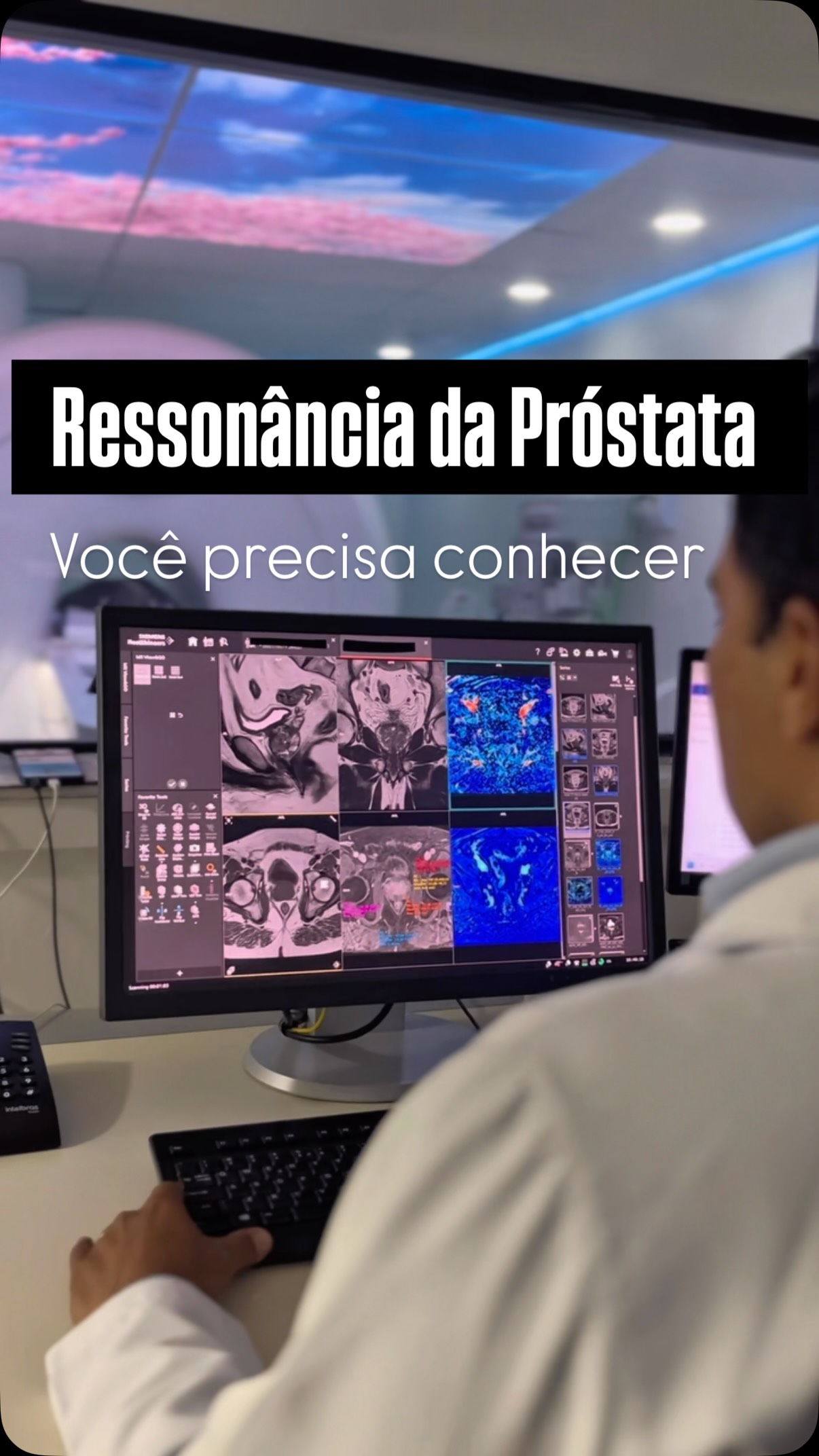 A ressonância magnética da próstata pode salvar sua saúde 👇
Muitos problemas começam silenciosos ⚠️
Quando surgem sintomas, pode ser tarde 😟
A RM é moderna, precisa e não invasiva 🧠
Detecta alterações com muito mais detalhe 🔍
Isso permite diagnóstico precoce 💪
E aumenta as chances de tratamento eficaz 🩺
Mais segurança nas decisões médicas 🙌
Homens acima de 40 anos: atenção 🚨
Histórico familiar exige cuidado redobrado 👀
Não espere sintomas para agir ❌
Previna hoje e viva com tranquilidade ❤️
#SaudeDoHomem #Prevencao #RessonanciaMagnetica #Prostata #DiagnosticoPrecoce
Agende seu exame na GAMA IMAGEM