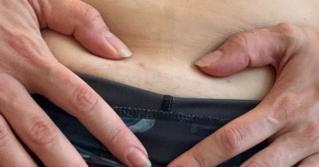 It’s C Section Awareness month ✂️
To all the moms who’ve been there-so have I.
My scar is still painful . I’m still working on my pelvic floor. Still shuffling through the trauma of such an unexpected experience that changed me as a doctor and mother.
Being a stronger advocate for mine and my baby’s health.
Being a provider that holds more space for postpartum healing in a physical and mental capacity
And being more aware of how healthcare routinely fails women and children, especially in this vulnerable state.
We want to be different.
Come as you are to our space, we welcome you with open arms
.
.
.
.
Chiropractic for moms, prenatal chiropractic, postpartum chiropractic, pediatric chiropractic, chiropractic for babies, chiropractic for kids, st louis park mn, Brooklyn park mn, crystal mn, wayzata mn, Minnetonka mn, Champlin mn, Minneapolis Mn, gentle manipulation, cranial sacral therapy, women owned business, moms of Minneapolis, boy mom, girl mom, abdominal surgery