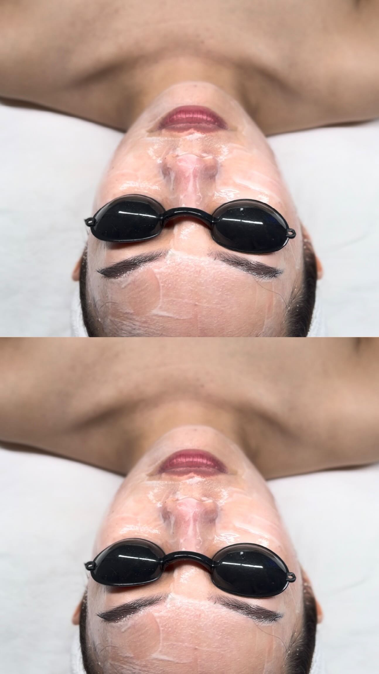 A little time for yourself goes a long way ✨🤍💫
Relax your mind, renew your skin🧖🏻♀️🧖🏻♀️🧖🏻♀️
@aernailbar
💌DM to book to book your appoinment today ✨
#fyp #boston #facial #acne #esthetician