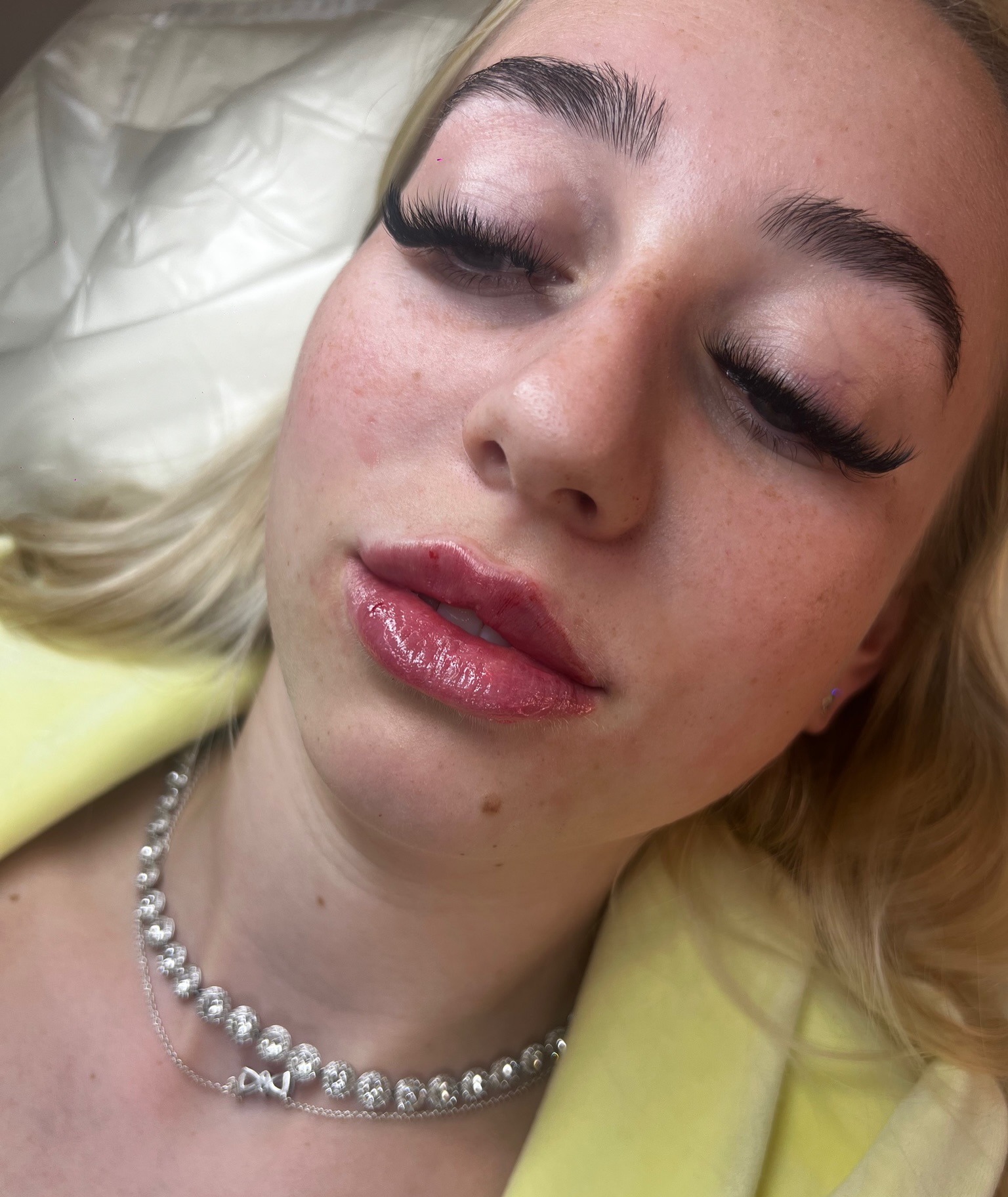 Love that lifted, doll-like lip look?
Russian lips might be for you!
Russian lips are all about height, definition, and shape — not just volume 🤍
Using a specialised technique, this style of filler can:
✨ Lift the cupid’s bow for a more defined shape
✨ Create that flat, heart-shaped “doll” lip look
✨ Add height rather than forward projection
✨ Keep results looking structured yet soft
✨ Enhance your natural lip shape in a more refined way
Perfect if you want a more sculpted, noticeable lip without the heavy, overfilled look ✨
Thinking about Russian lips?
DM now to book your consultation and let’s create your perfect shape ✨
#EliteAesthetics #WakefieldAesthetics #RussianLips #LipFillerUK DefinedLips