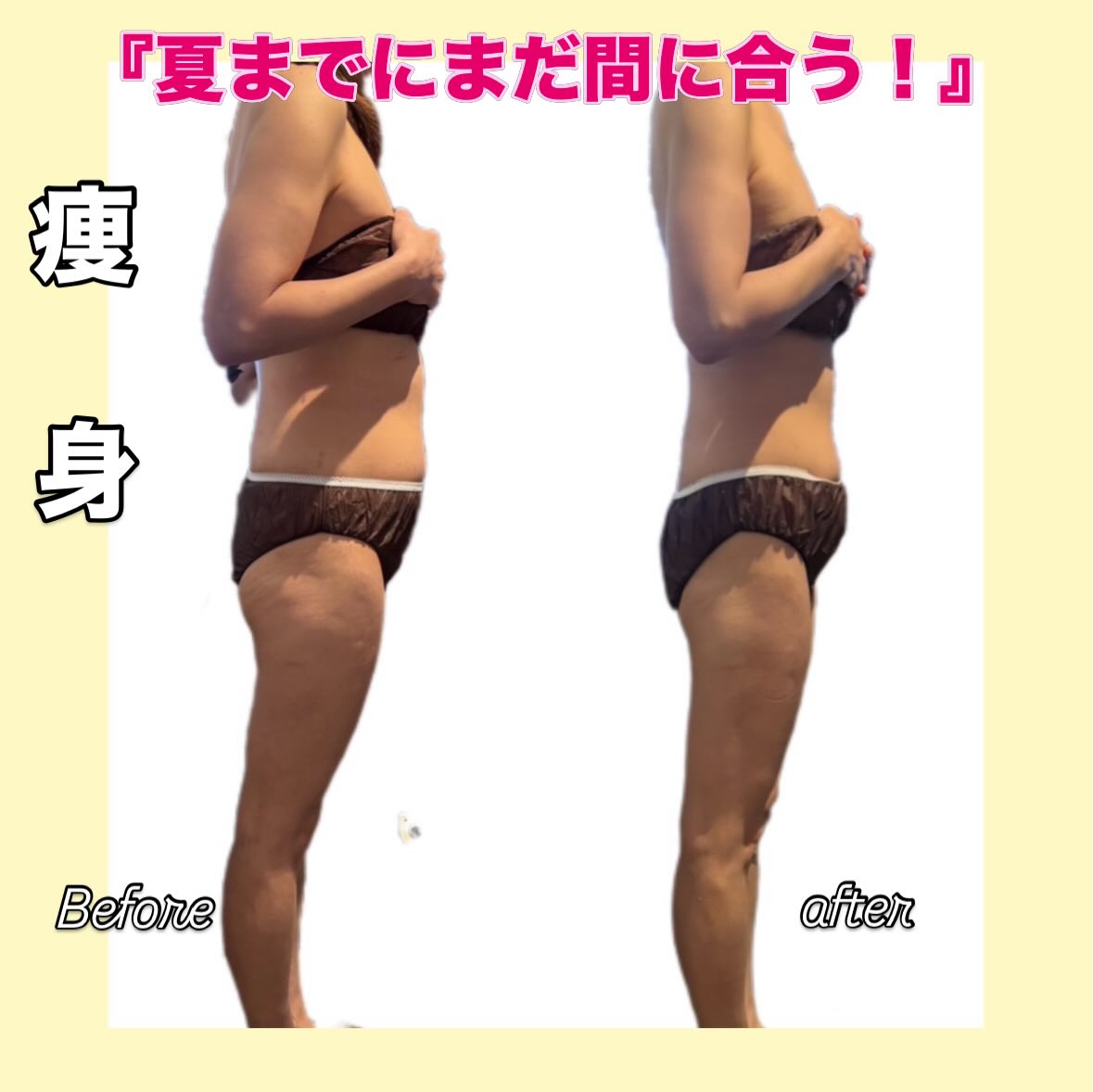 「夏までに、まだ間に合う。」
この差、見てください。
ただ痩せるだけじゃなく
✅お腹スッキリ
✅太もも引き締め
✅横からのラインが変わる
自己流では変わらなかった方も
結果が出ています。
✅何しても痩せない
✅下半身だけ落ちない
✅年齢とともに痩せにくい
そんな方こそ一度体験してください。
“今始める人”だけが
夏に間に合います。
本気で変わりたい方、お待ちしてます👍
🧚🏼ご予約はホットペッパーから📩
#痩身 #門真エステ #ダイエット
#本気痩せ
〜 〜 〜 〜〜〜〜〜〜〜〜〜〜〜〜
🌿エステサロン ジュブリをーへの
ご予約はこちらからhttps://beauty.hotpepper.jp/kr/slnH000398423/?vos=cpahpbprosmaf131118005
🌿ホームページ
https://www.esthesalon-jebrille.com/school