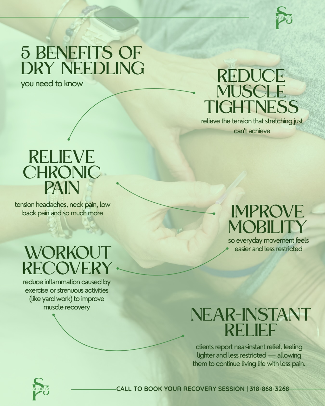 Dry needling helps stimulate blood flow, reduce muscle tension, calm irritated nerves, and trigger the release of endorphins — the body’s natural pain-relieving and feel-good hormones — all while helping you move with less pain and restriction. ✨
Whether you’re dealing with chronic tightness, workout soreness, headaches, or stubborn pain that won’t go away, dry needling may help get you back to feeling like yourself again.
📍We offer cash-based dry needling sessions at Studio P3. Message us or call to book your appointment!
#sp3 #pilatesbasedphysicaltherapy #dryneedling