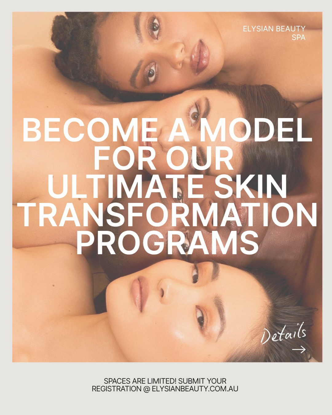 Are you ready to reset and transform your skin?
We’re seeking a handful of models to experience our 12‑Week Skin Reset, 6-month skin clarity and 6‑Month Collagen Reset programs at 50% off!
This opportunity is perfect for you if you’re struggling with:
• Ongoing acne or lingering acne scars
• Enlarged or clogged pores or rough texture
• Dull or “lifeless” skin
• Fine lines, wrinkles or mild pigmentation
Spaces are limited! Send us a DM or call 9364 9903 to secure your spot.
We can’t wait to help you achieve your dream skin at Elysian Beauty!
#SkinReset #CollagenReset #ModelCall #SkinTransformation PerthAesthetics