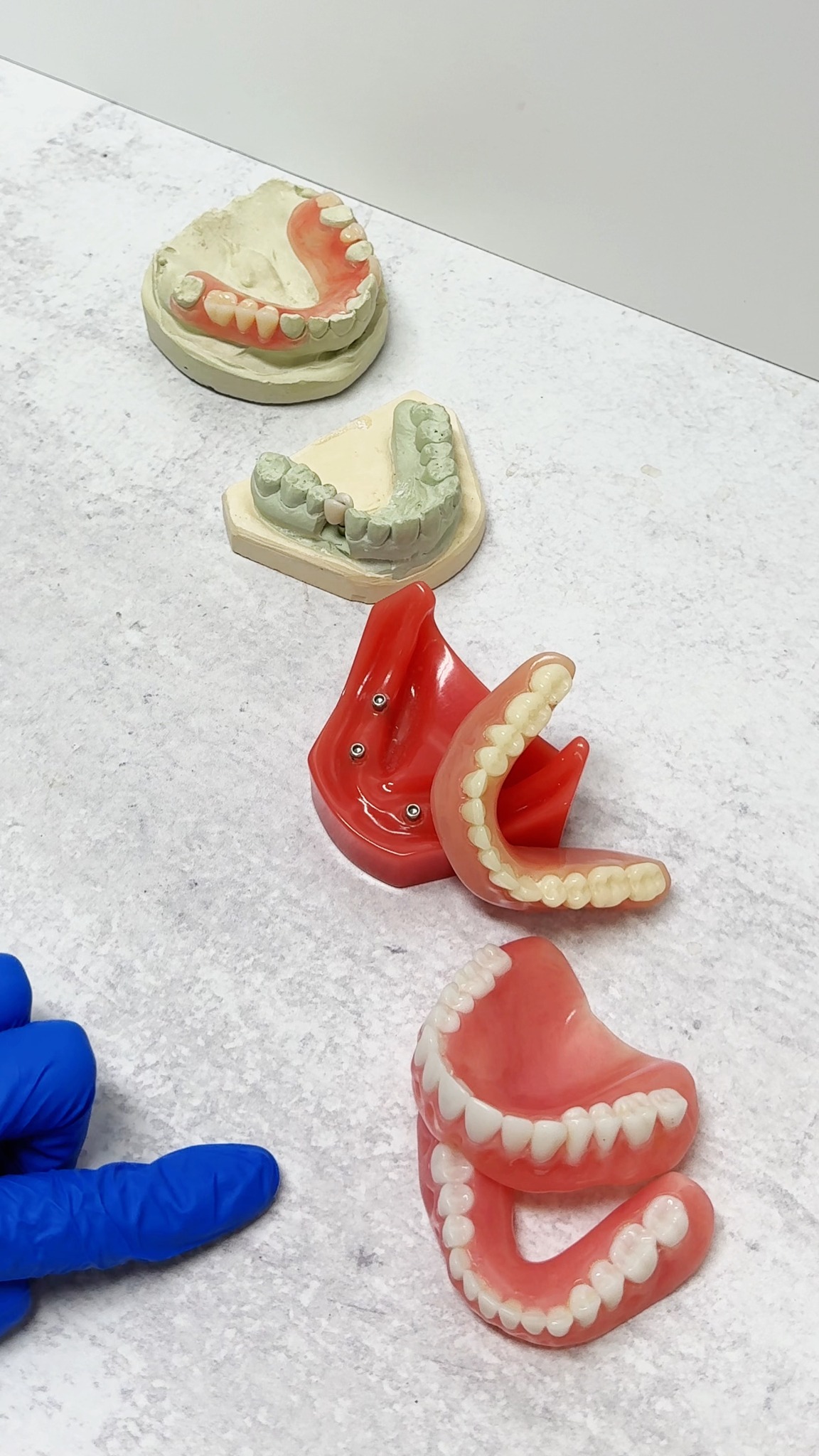 No two smiles are the same, and your denture options shouldn’t be either 🦷
At Crown & Denture Solutions, we offer a variety of denture solutions designed around your needs, comfort, and lifestyle. From traditional and partial dentures to snap-in and implant supported options, our team helps you find the fit that feels right for you.
With our on-site denture lab, we’re able to customize, adjust, and refine your dentures right here in-office for a more personal experience, a better fit, and even Teeth in a Day treatment options.
Whether you’re exploring dentures for the first time or looking for an upgrade, we’re here to walk you through every option and help you smile with confidence again.
📞 Call 318-232-4404 to schedule your free X-ray & exam.
#Dentures #SnapInDentures #PartialDentures #ImplantDentures #DentureLab