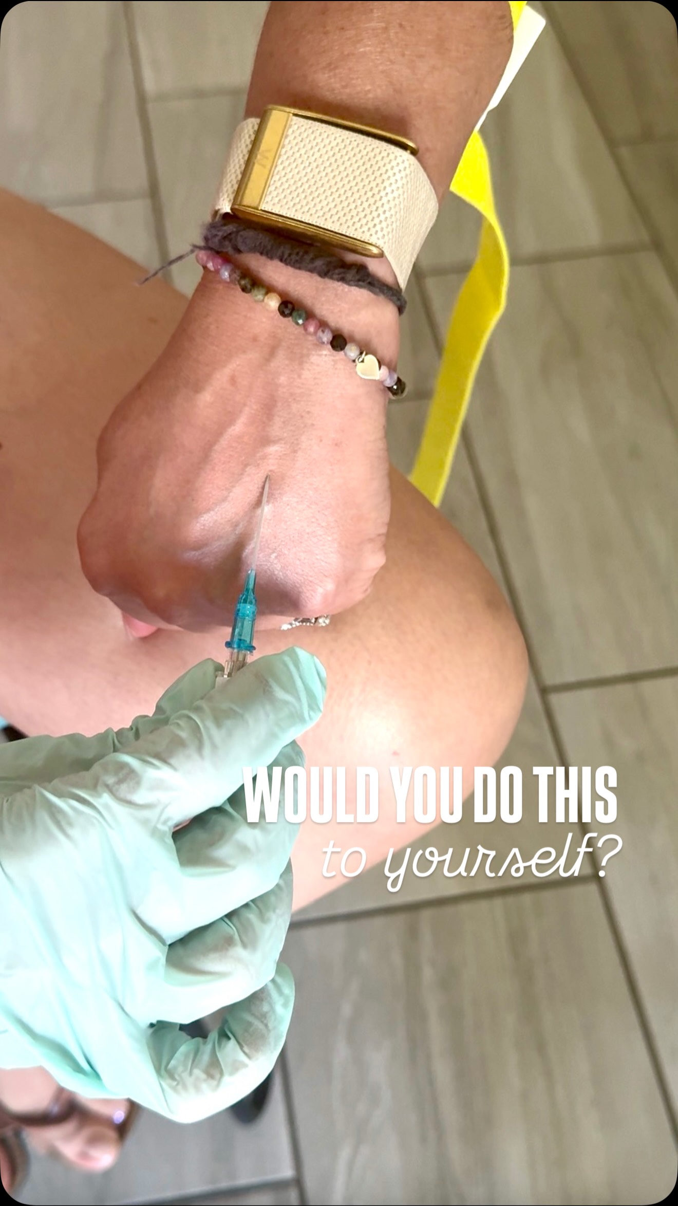Nurses watching this: “solid vein.”
Everyone else: “absolutely not.”
Me, becoming my own patient for the internet.
#nurselife #ivtherapy #wellness #nursehumor