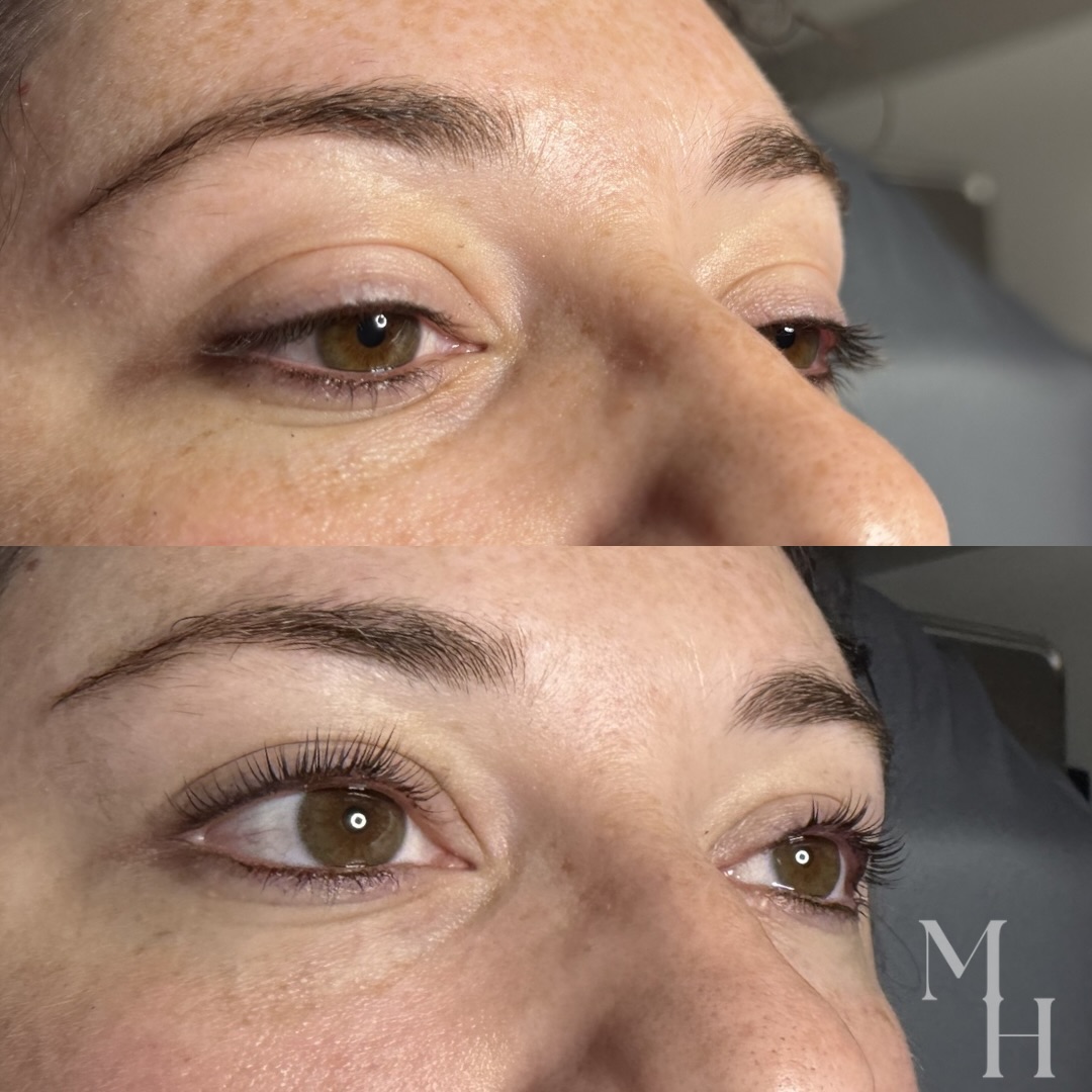 opening up the eye area with a little lash lift + tint 👏🏻
📍 Location:
664 Scranton Road, Suite 101
Brunswick, GA 31520
Inside Skinology Clinical Skincare
💬 Let’s Chat About Your Esthetic Goals!
📲 Call/Text: 912-223-9954
💌 DM or Facebook Messenger
🗓️ Schedule a Consultation Anytime
💻 Book Online 24/7 (link in bio)