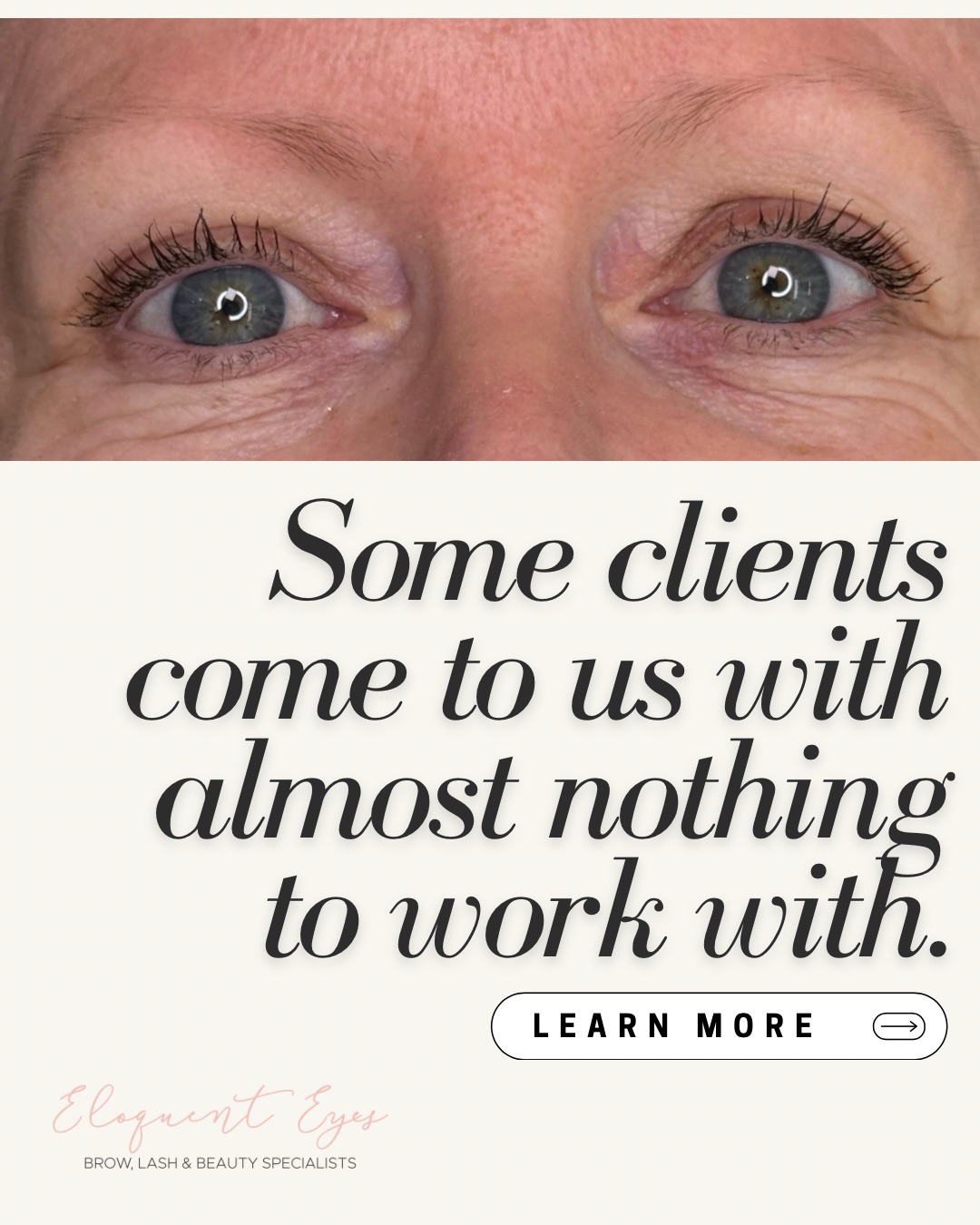Not every client walks into a salon with full brows or long lashes.
Some women come to us after chemotherapy.
Some have alopecia.
Some have spent years feeling like there’s “nothing there” to work with.
Those appointments are never just about beauty.
They’re about helping someone feeling confident about themselves again.
Creating natural-looking results when there’s very little to work with takes a completely different level of skill, care and consultation.
It’s not about making someone look overdone.
It’s about creating something soft, believable and confidence-boosting from the starting point they have.
If you’ve ever been told there’s not enough there…
Please know there are options.
Comment CONSULT or send us a message privately and we’ll guide you through what may be possible for you 🤍
Margie & The EE Team xo
#perthbeautysalon #pmuperth #perthlashes #perthbrowstylist