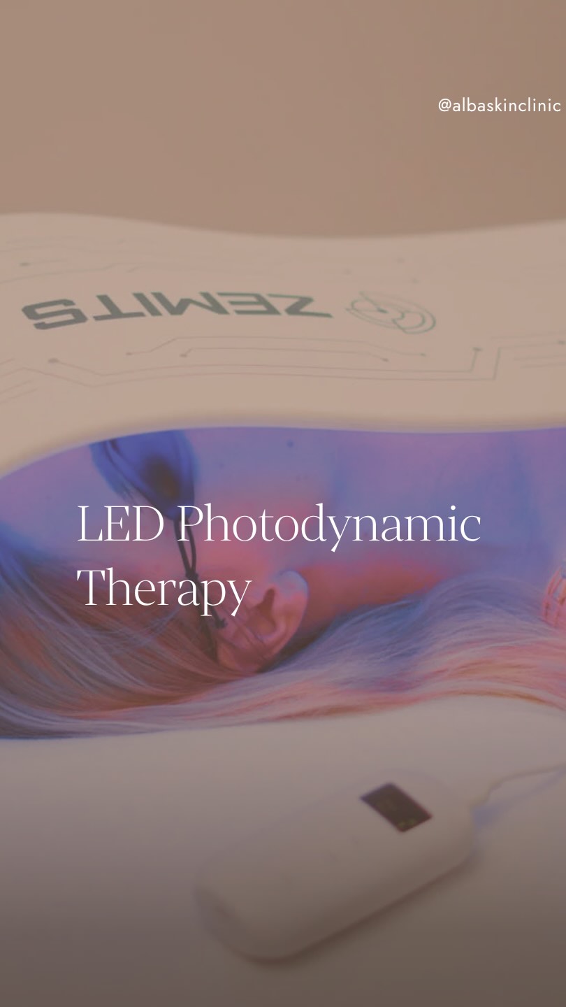 LED Photodynamic Therapy is one of our favourite non-invasive treatments for supporting healthier, clearer and more radiant skin. ✨
At ALBA Skin Clinic we use the advanced @zemits_unitedkingdom VivaLumix medical-grade LED system featuring FDA-cleared wavelengths, CE-certified technology and clinically backed light therapy protocols.
Why clients love LED therapy:
✨ Suitable for most skin types
✨ Completely non-invasive
✨ No downtime
✨ Comfortable & relaxing treatment
✨ Perfect as a stand-alone facial or alongside other treatments
LED therapy can also be used to support recovery following treatments such as microneedling, facials and skin rejuvenation procedures.
@albaskinclinic
📍 Cirencester
📲 Book your consultation via the link in bio
#ledtherapy #photodynamictherapy #redlighttherapy #bluelighttherapy #infraredtherapy