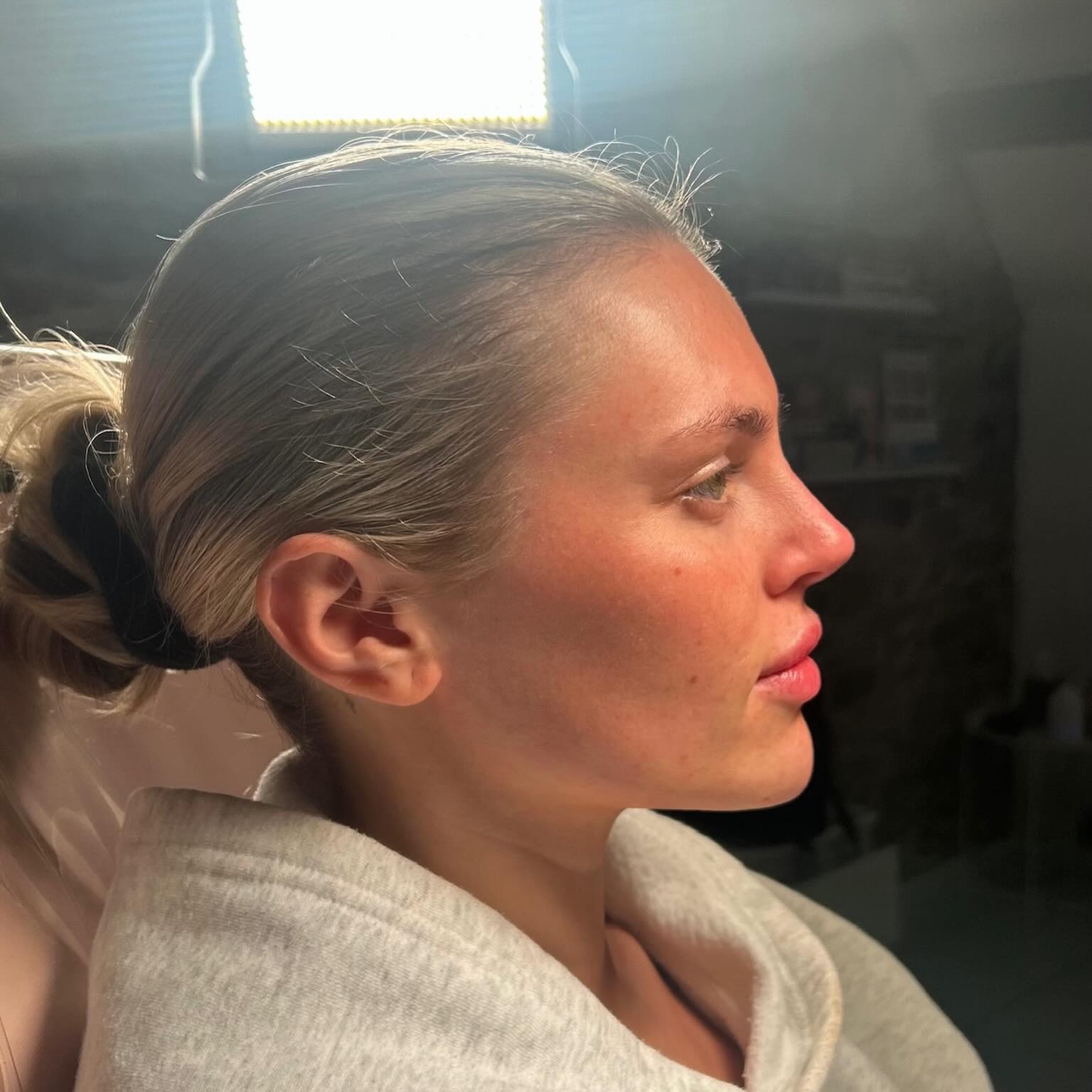 ⠀
Side profile of dreams ☁️😍
__________________________
Get in touch 👇🏽
𝐃𝐌 𝐔𝐒 𝐅𝐎𝐑 𝐄𝐍𝐐𝐔𝐈𝐑𝐈𝐄𝐒
GIFT VOUCHERS AVAILABLE
SWIPE FOR CLINIC DATES
⭐️ 5 STAR GOOGLE REVIEWS
💻 www.archedaesthetics.co.uk
📱 𝗪𝐇𝐀𝐓𝐒𝐀𝐏𝐏 07517416782
📧 hello@archedaesthetics.co.uk
#lipfillerplymouth #dermalfillerplymouth #aestheticscallington #dermalfillercallington #aestheticsliskeard