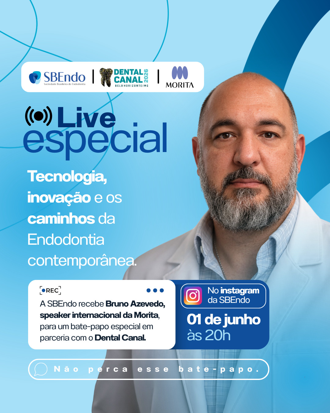 A SBEndo, em parceria com o Dental Canal e a Morita, promove uma live especial com Bruno Azevedo, speaker internacional da Morita.
Um bate-papo sobre tecnologia, inovação e os avanços da Endodontia contemporânea.
📅 01 de junho
⏰ 20h
Não perca.
#SBEndo #Endodontia #Morita #DentalCanal #Odontologia #LiveSBEndo