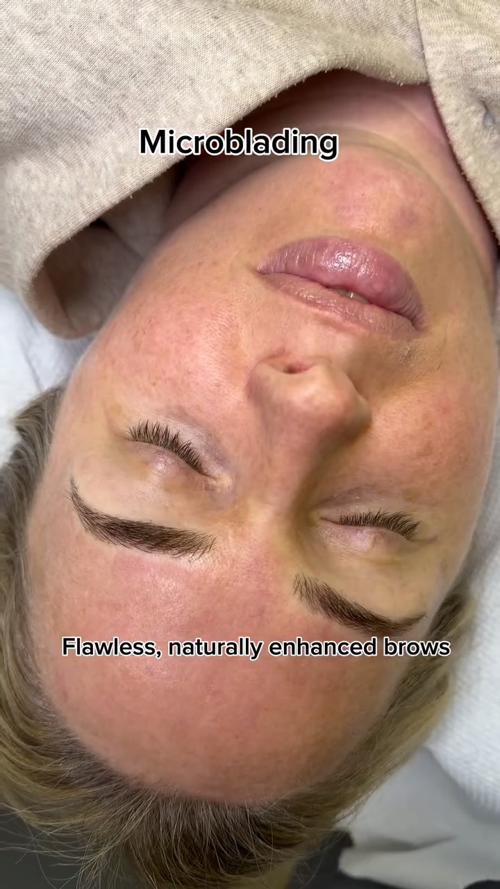 Some brows don’t need makeup… they need precision ✨
Microblading is a technique that creates ultra-fine hair strokes to rebuild shape, fill sparse areas, and lift the natural expression of the face.
✔ Natural-looking definition
✔ Fills gaps seamlessly
✔ Soft, balanced results without daily makeup
Flawless brows, designed to look like your own ✨
www.belenspmustudio.com
info@belenspmustudio.com
#microblading #cardiff #browsonfleek #cardiffbrows