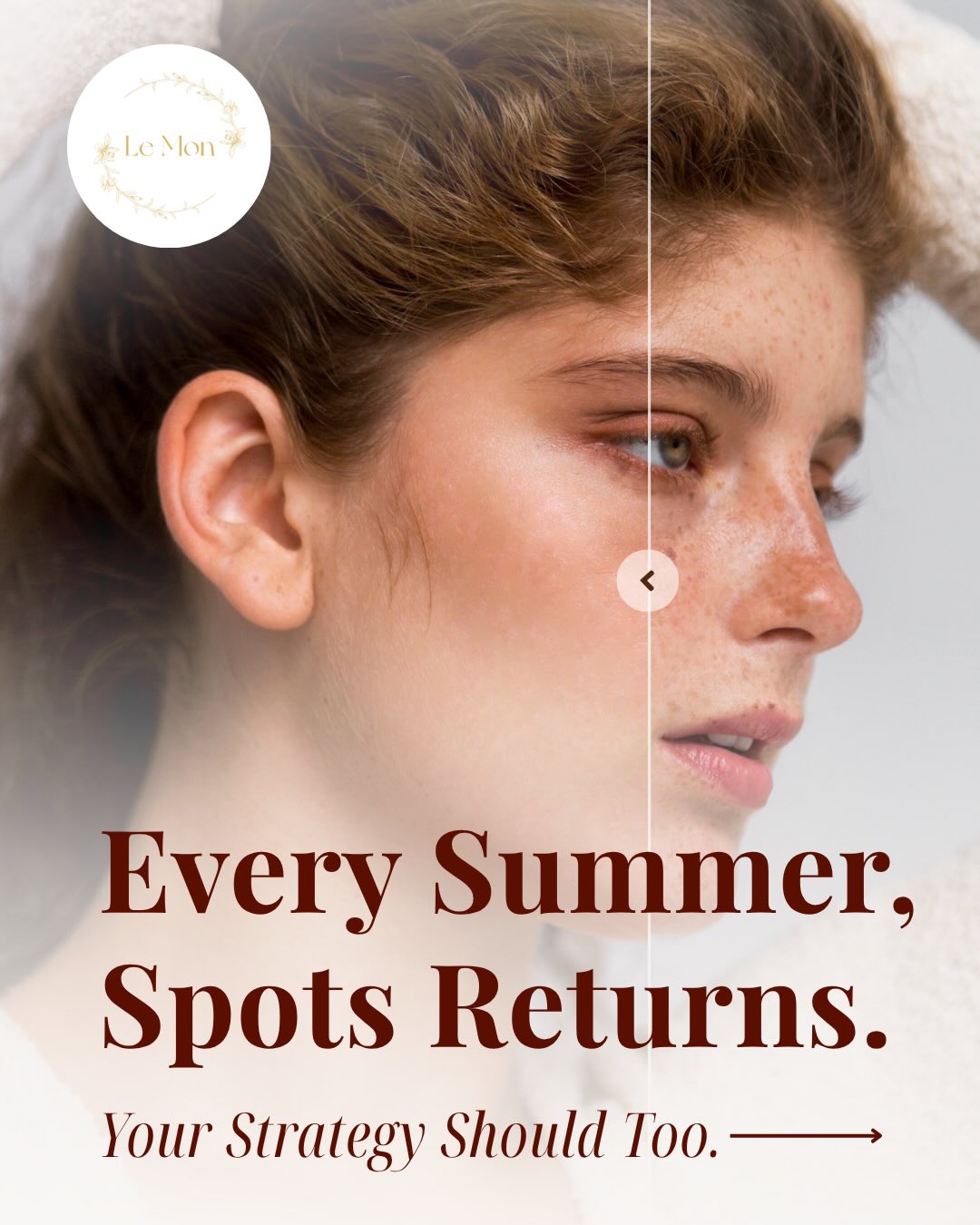 Summer is here — and so is pigment season☀️
This June, Le Mon Aesthetics introduces our newly upgraded multi-phase pigment management protocols inspired by advanced clinical training in Seoul.
Designed with a more thoughtful approach to melasma management, sun damage, freckles, and stubborn pigmentation concerns.
Why the upgrade? Because pigmentation is rarely surface deep.
Our newly refined protocols combine advanced Helios IV™️ Pico technology with individualized treatment planning to support:
✨ Melasma Management
✨ Sun Damage & Freckles
✨ Age Spots & Dark Spots
✨ Post-Acne Pigmentation
✨ Long-Term Pigment Control
Each includes a complimentary VISIA®️ Skin Analysis to better understand pigment distribution beneath the surface and personalize your protocol.
Limited June availability now open. Scan the QR code and book now!
#pigment #pignmentation #melasma #sundamage #pigmentcontrol