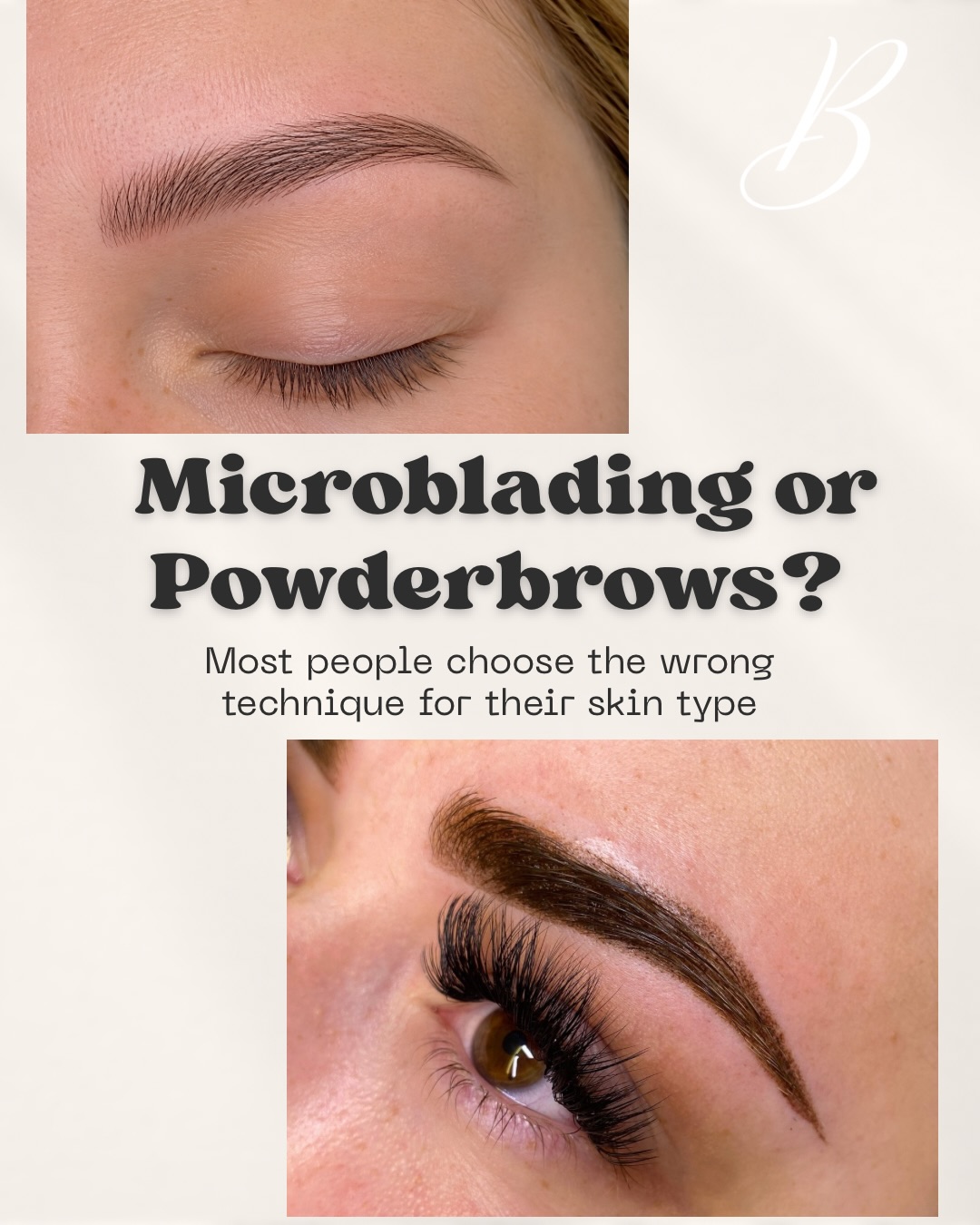 Microblading or Powder Brows ✨
Do you really know the difference?
It’s not about which technique is “better,” but about which one is most suitable for you. Every skin type, lifestyle, and desired result requires a different approach.
When the time comes to get your brows done, or if you are still deciding which technique to choose, this post is for you 🤍
If you have any questions, you can book a consultation through my website.
www.belenspmustudio.com
info@belenspmustudio.com
#microblading #powderbrows #pmu #permanentmakeup #cardiffbrows